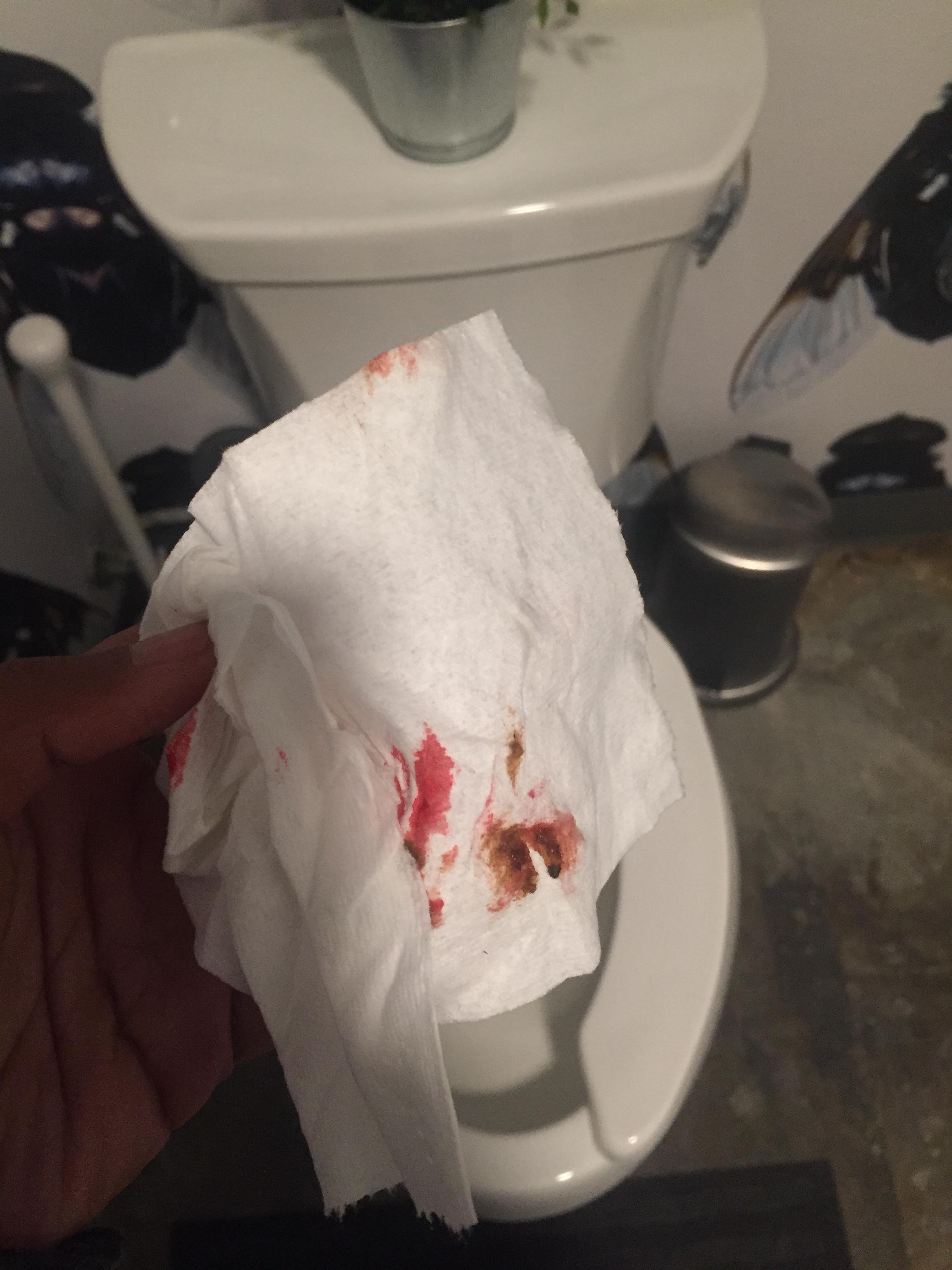 Blood when wiping shittingadvice