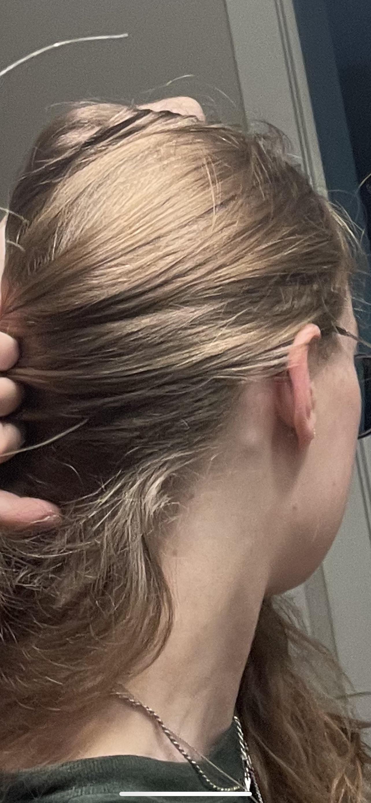 Hard lump behind ear, does anyone know what it is? r/AskDoctorSmeeee
