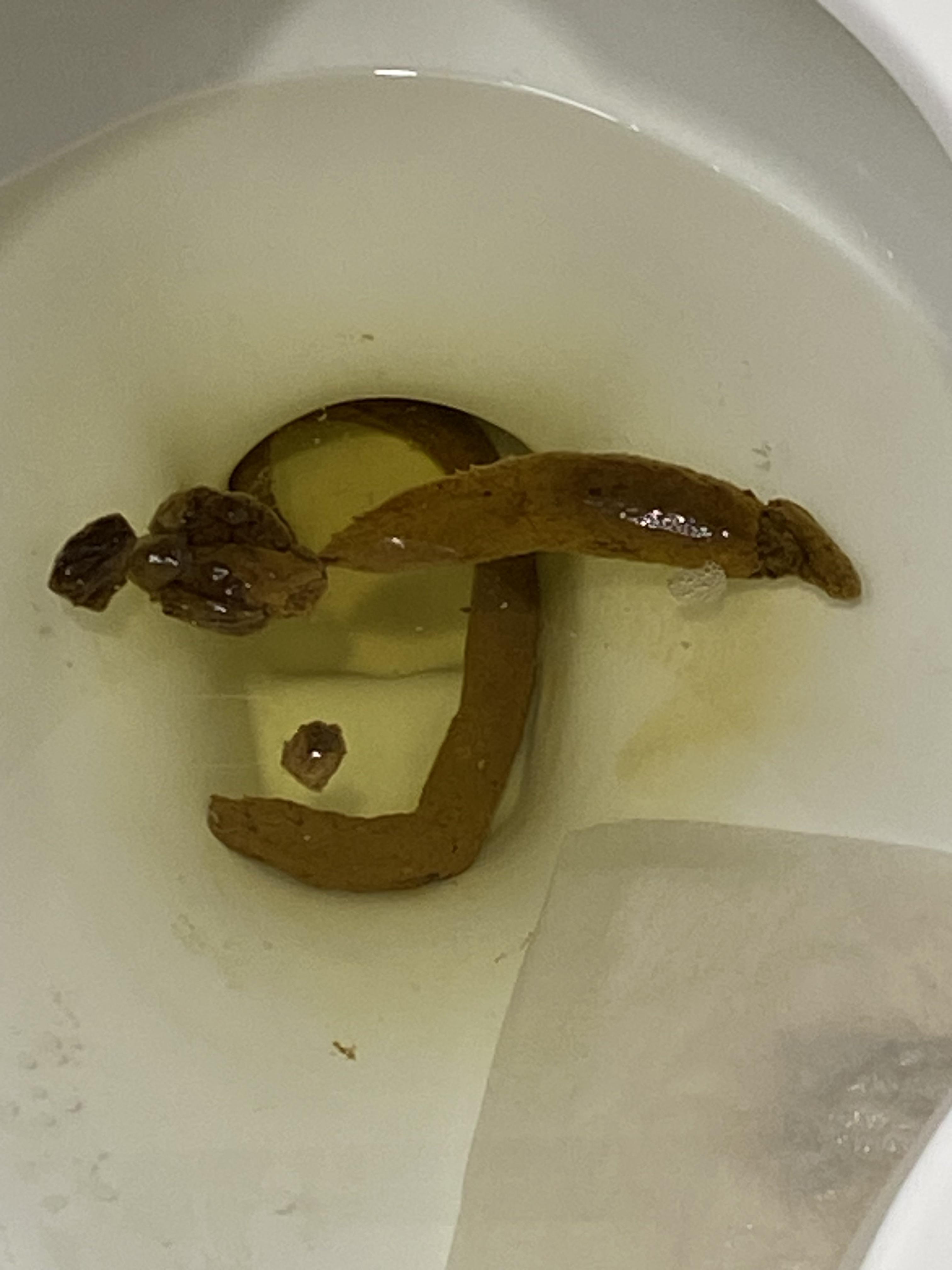 Is this colon cancer😓 r/poop