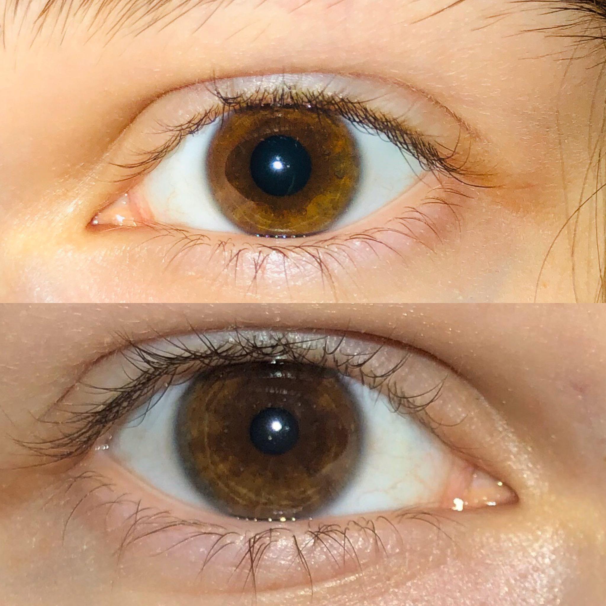What are these golden rings in my eyes? (Left eye on top, right on