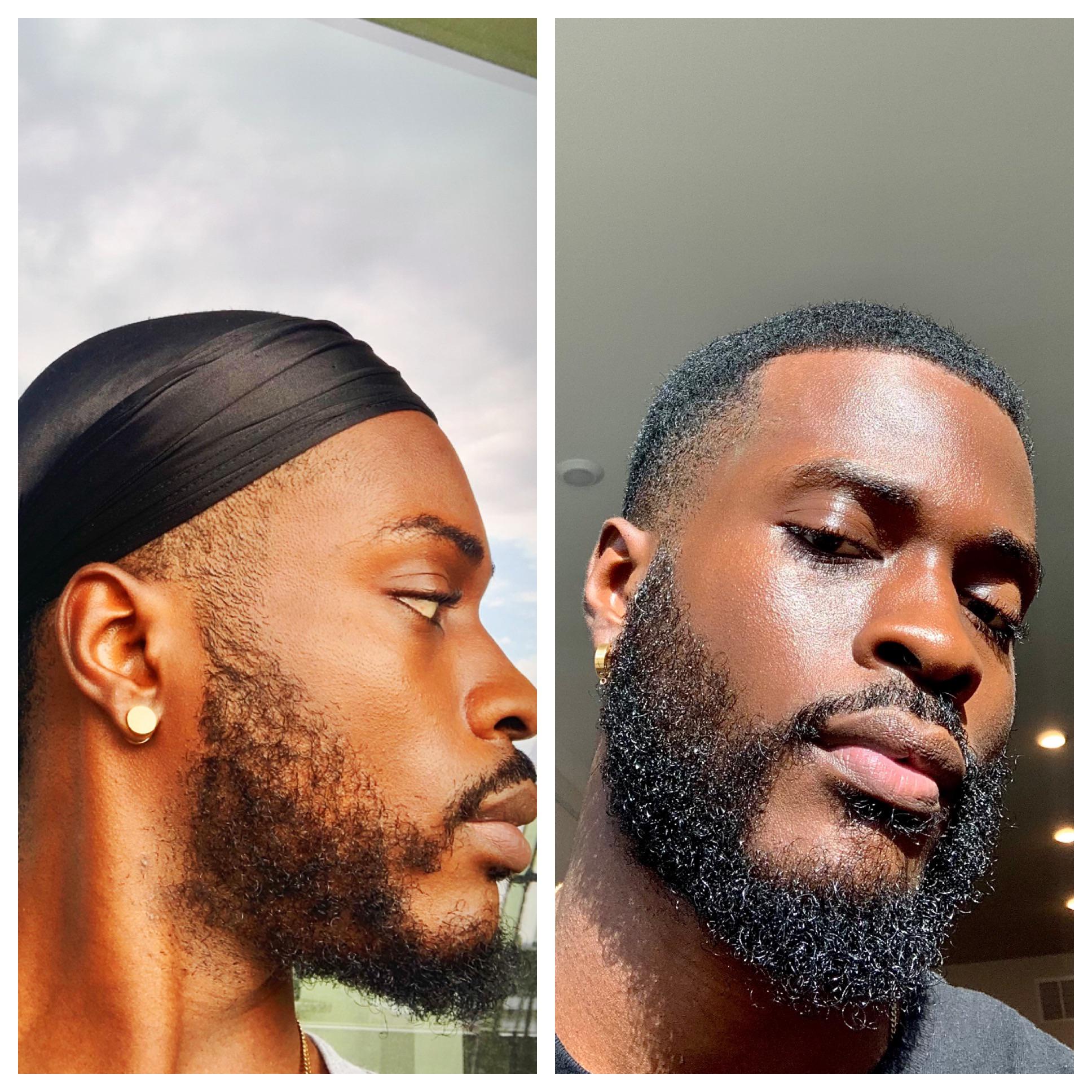 4 months of growth, AND proper care. Don’t let them tell you you can’t