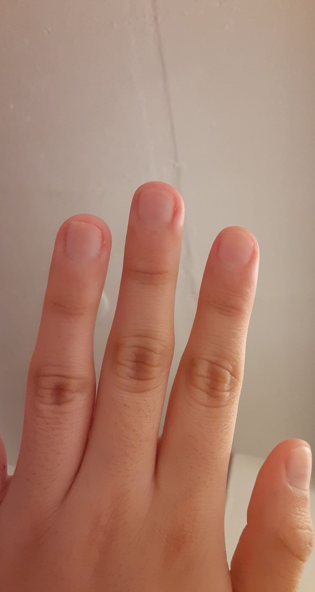 What are these faint white lines on my nails? Am I okay? I'm scared 😥