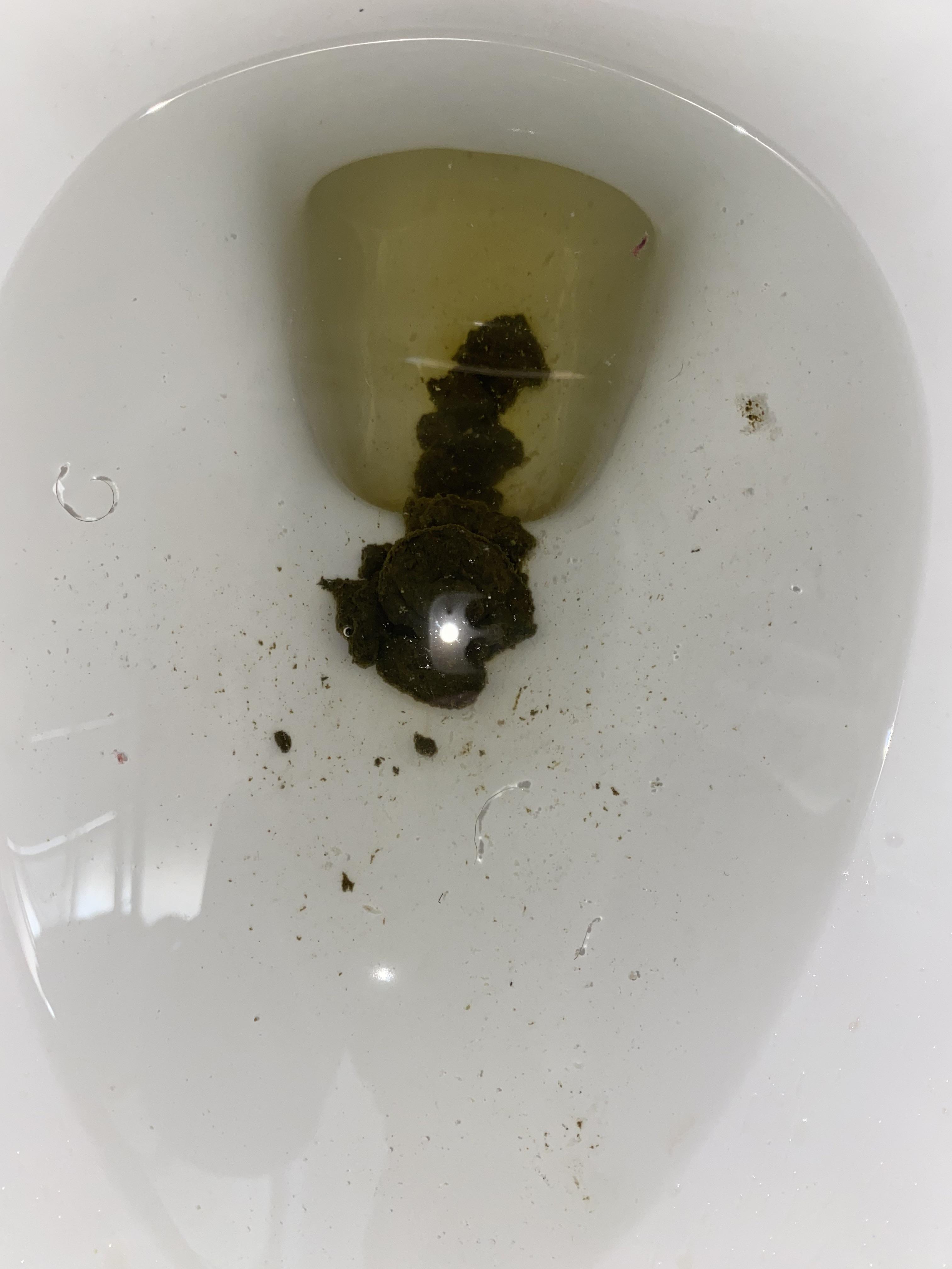 Very Dark green poop/Diarrhea. Stomach gurgling. Should I be worried