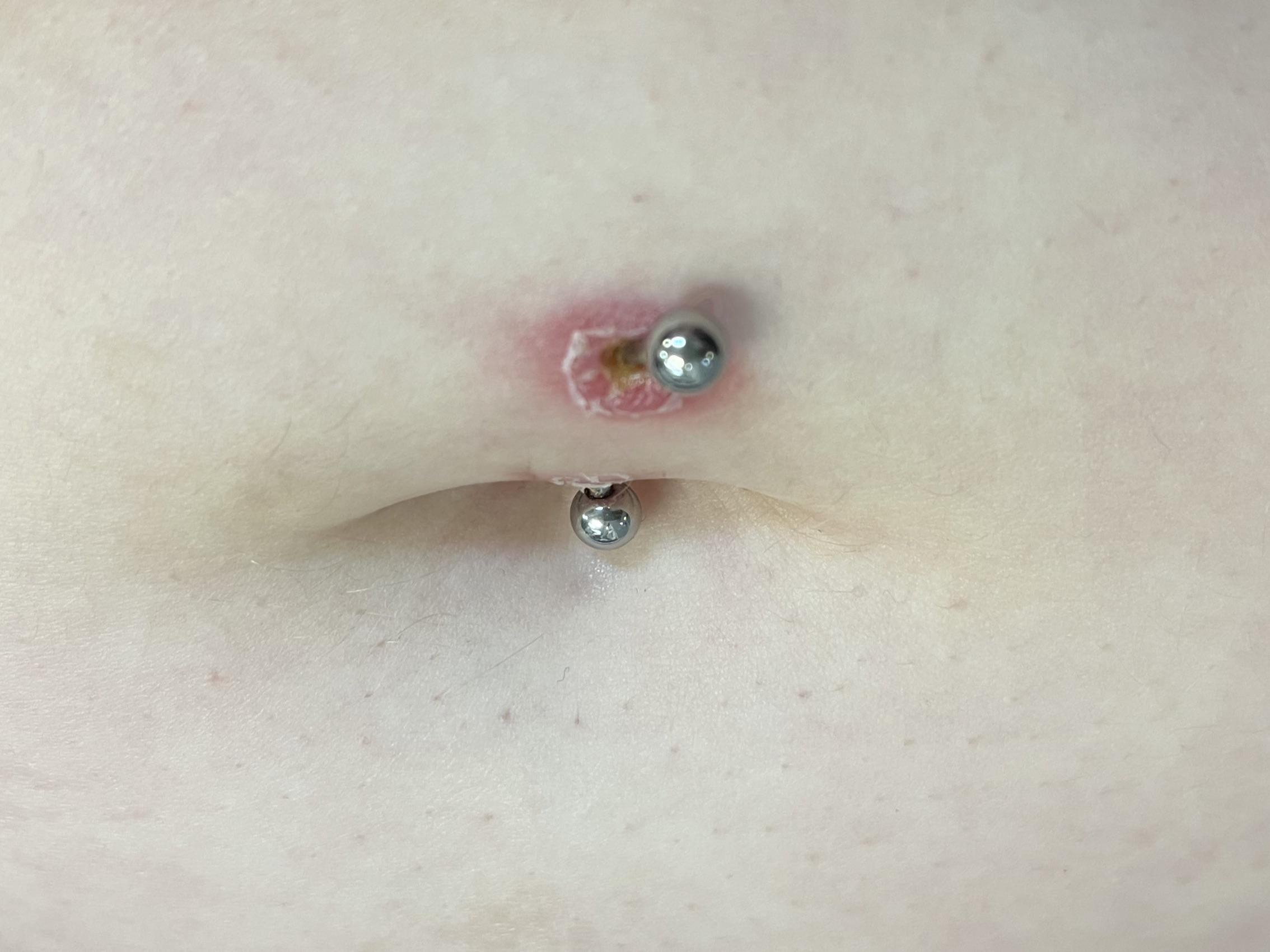 Possible infected belly piercing?? r/piercing