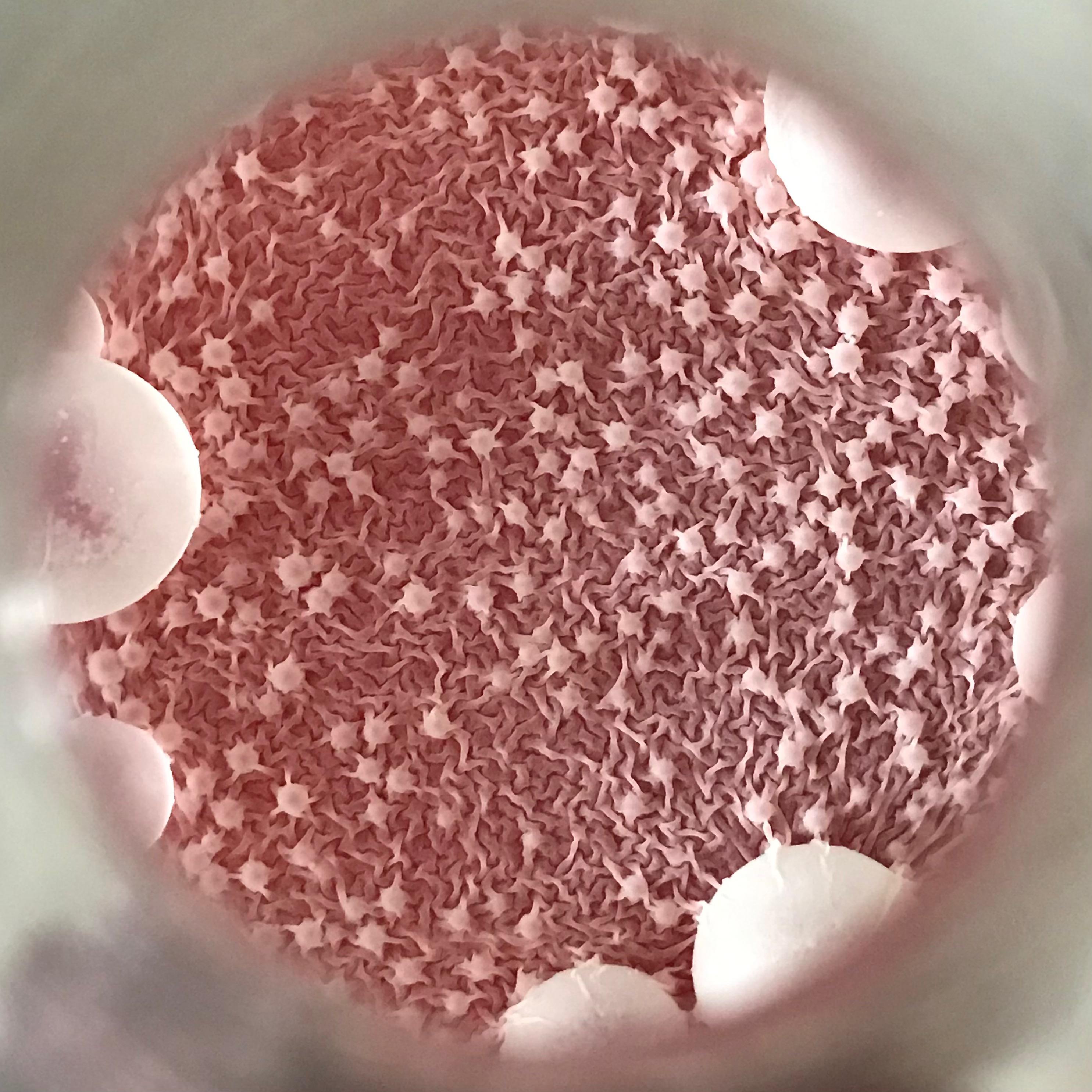 Best Pomegranate Juice Posts Reddit