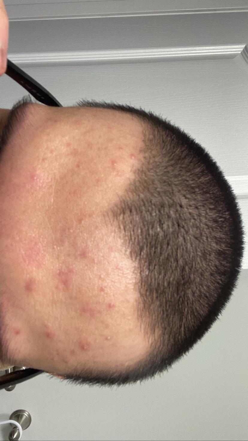 I never break out but started to use moisturizer lately. I use the