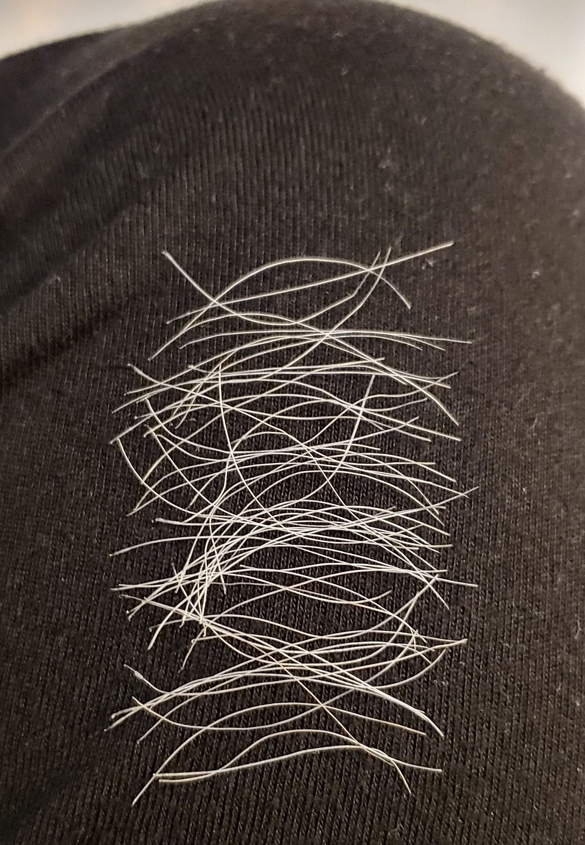 Sometimes I pluck the white hairs from my beard. r/mildlyinteresting