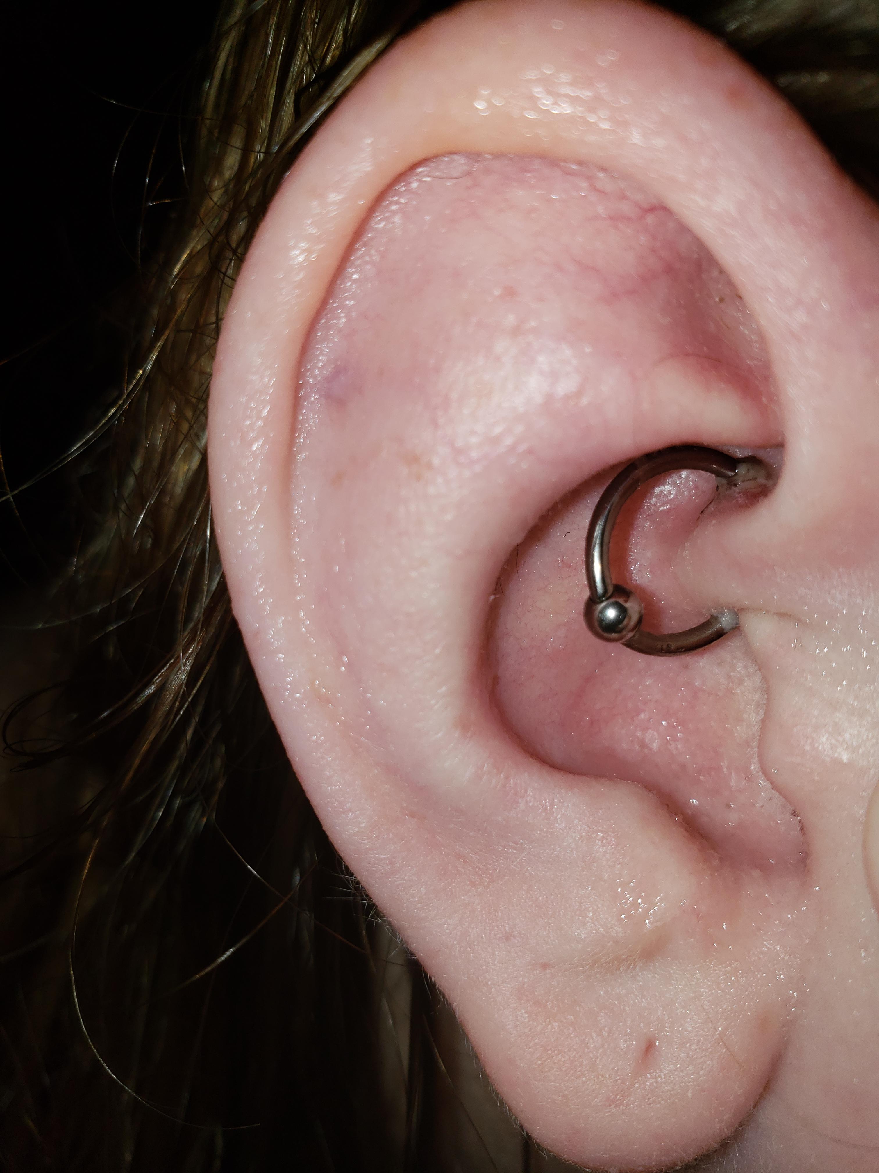 Is my daith healing normally? It looks pretty scary and I
