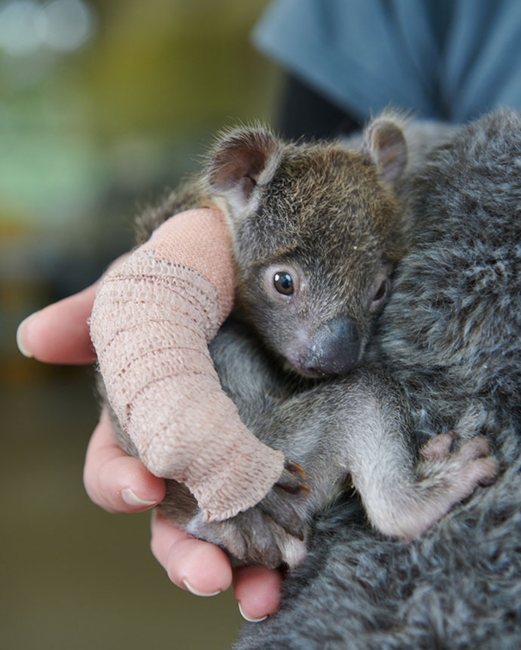 This baby koala got a tiny arm cast after falling out of a tree. Just look at that face... r/aww