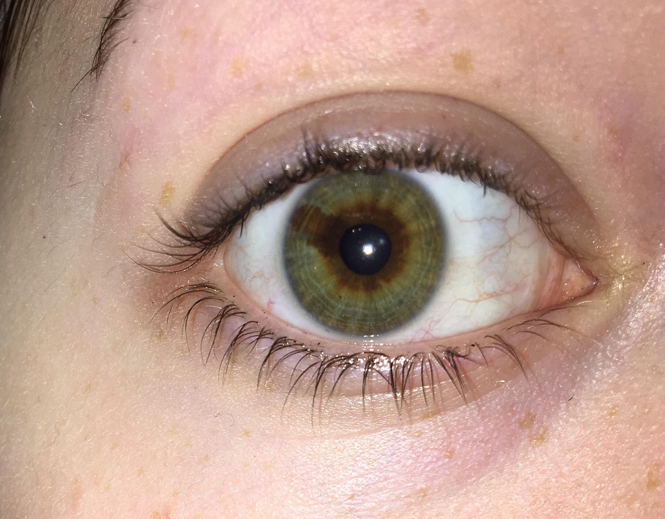 Heterochromia Eyes Brown And Green
