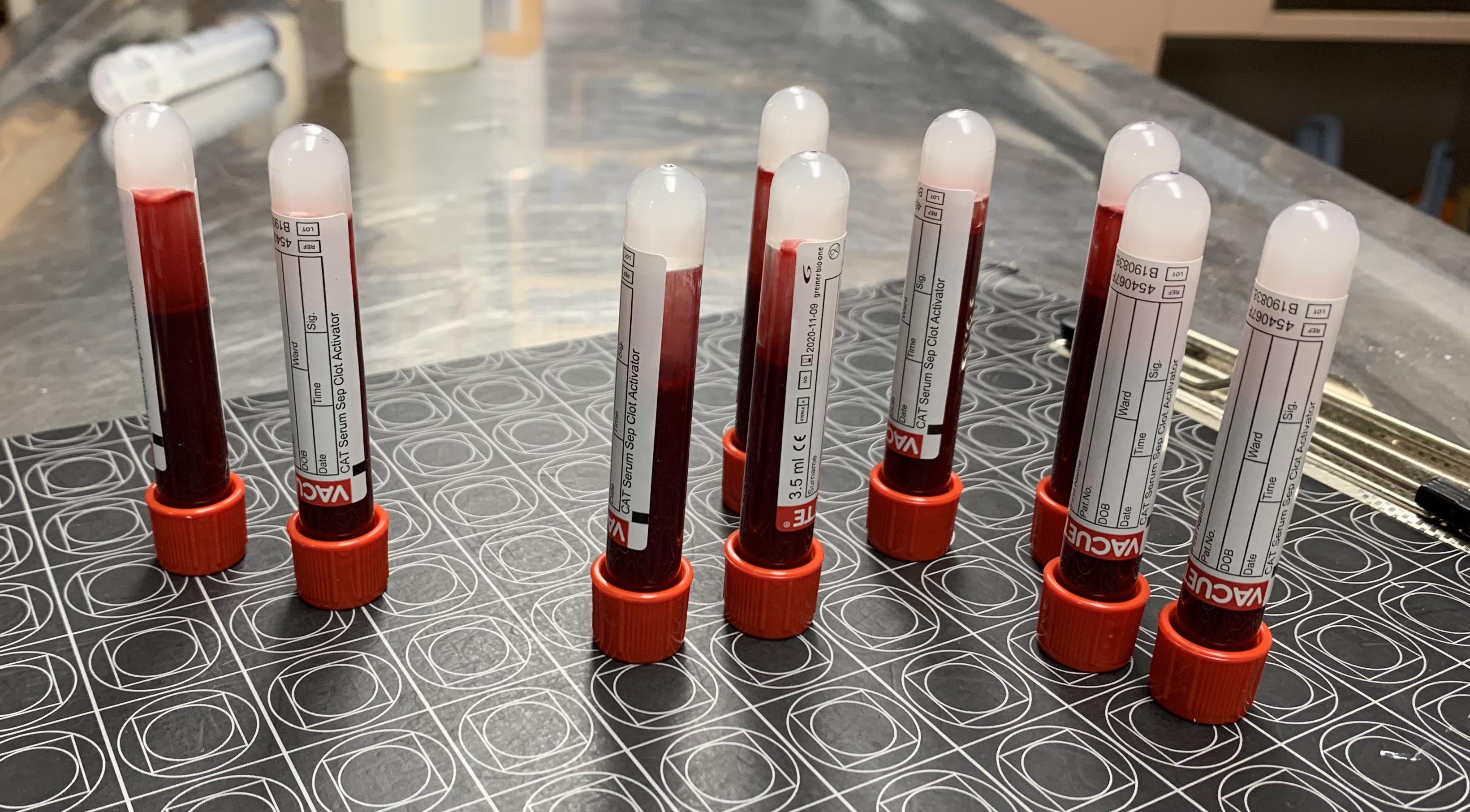 TFW your pDVM prescribes autologous serum eye drops, but your patient