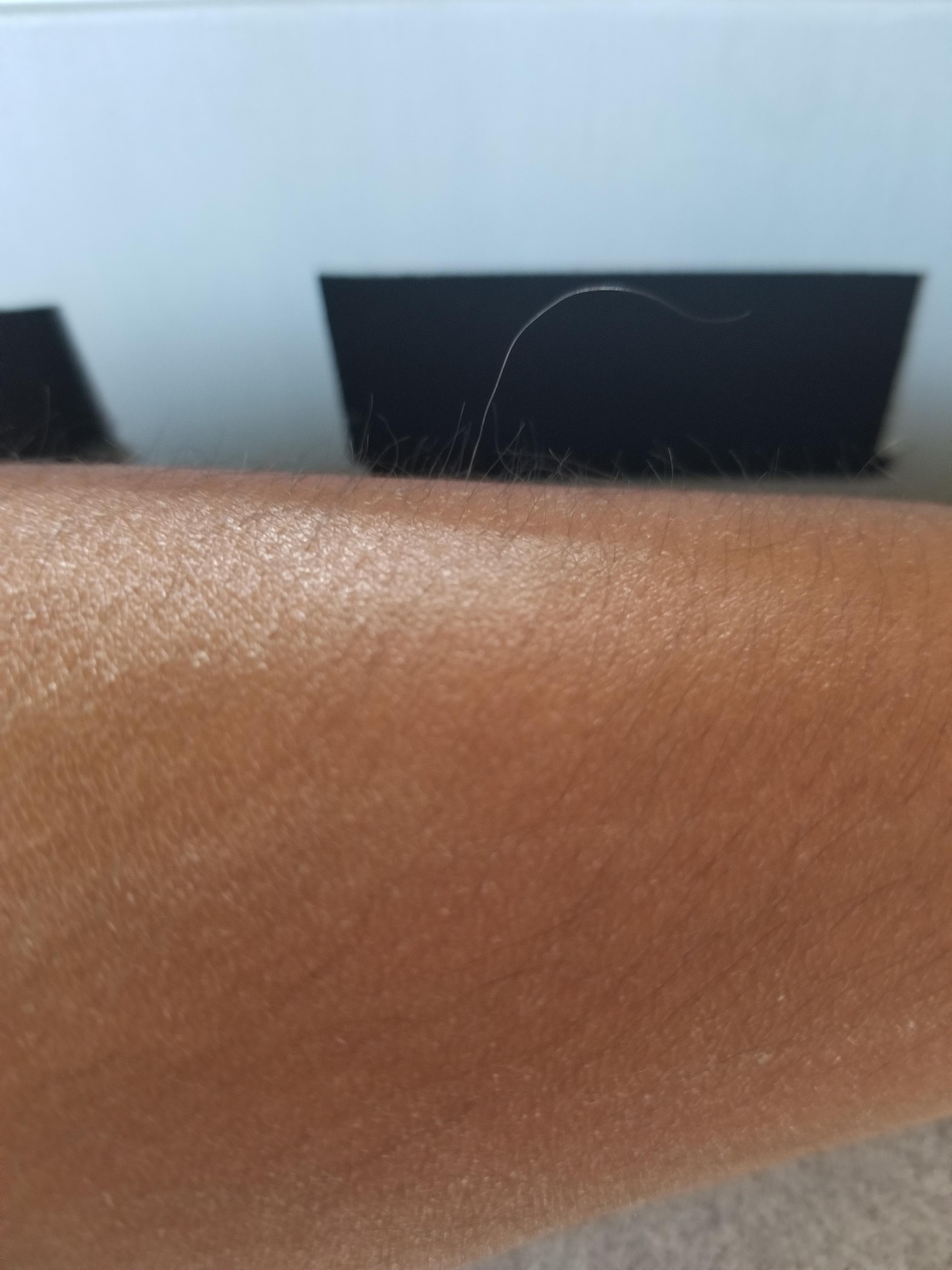 This one really long arm hair. r/mildlyinteresting
