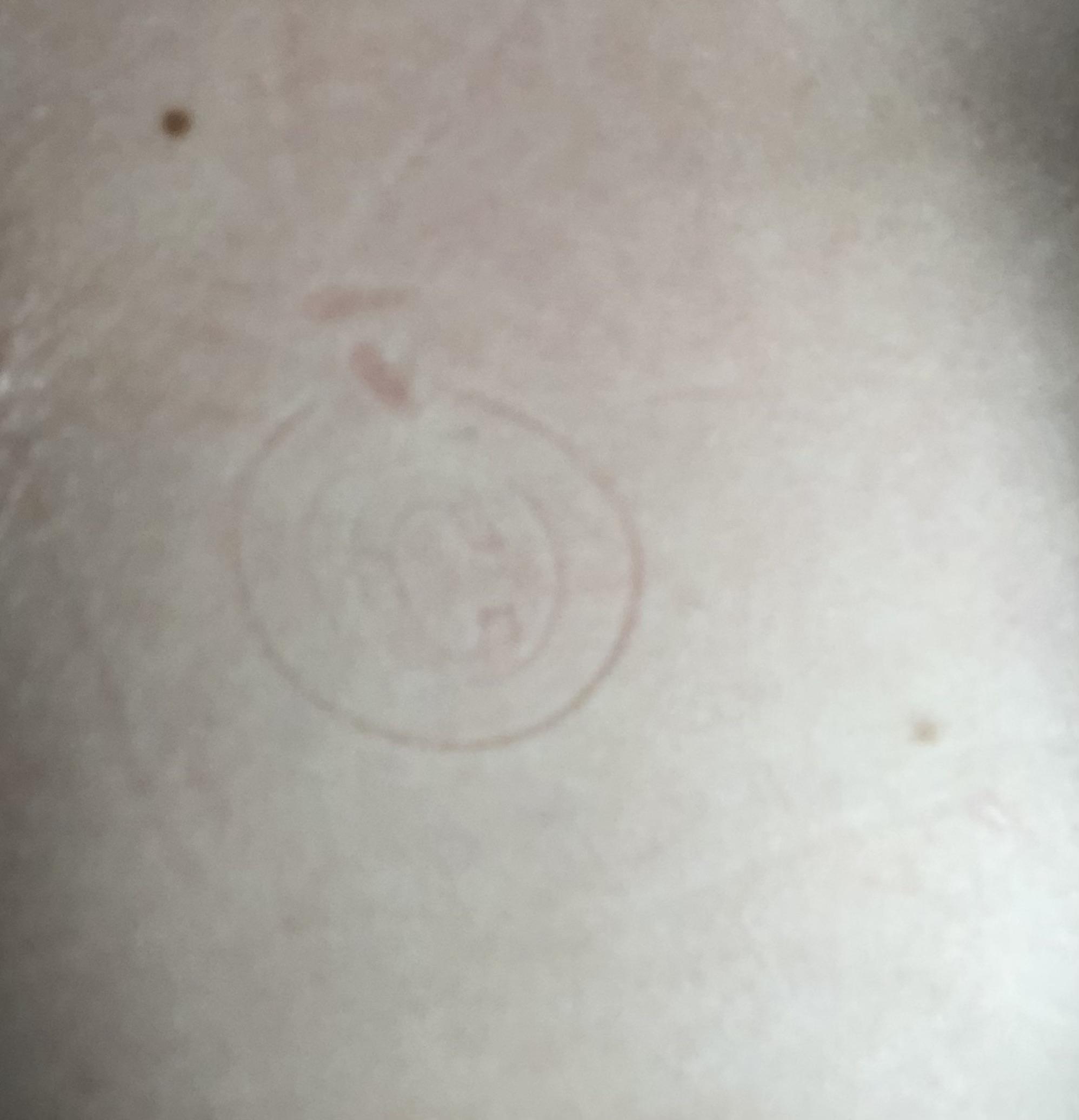 What happens when you sleep with a necklace on r/mildlyinfuriating