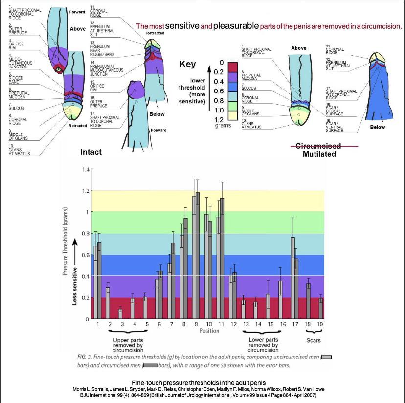 Penile Fine Touch Sensitivity Diagram, Cut vs Uncut. Based on Sorrells