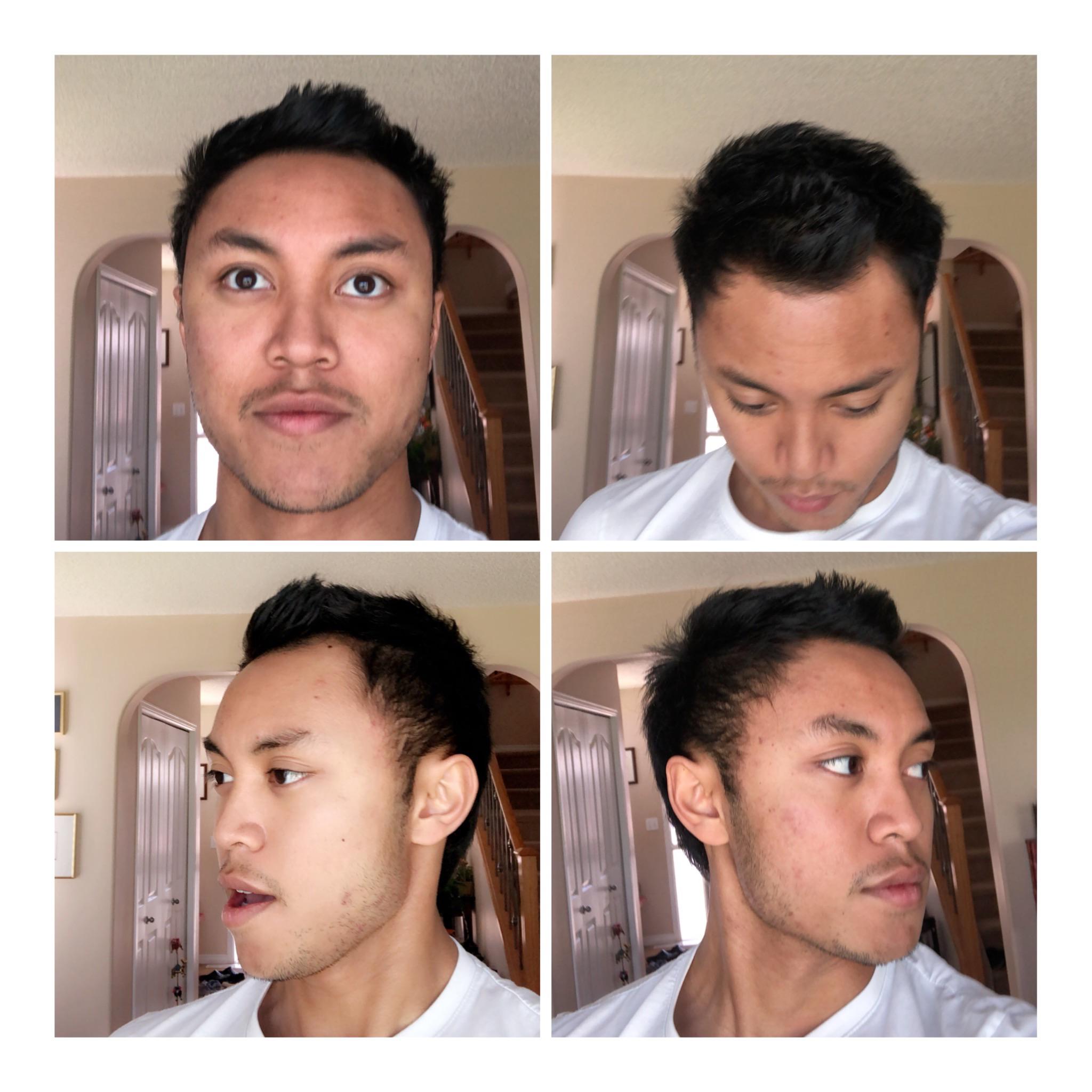 Found the haircut to suit my receding hairline. Thoughts? Hairloss