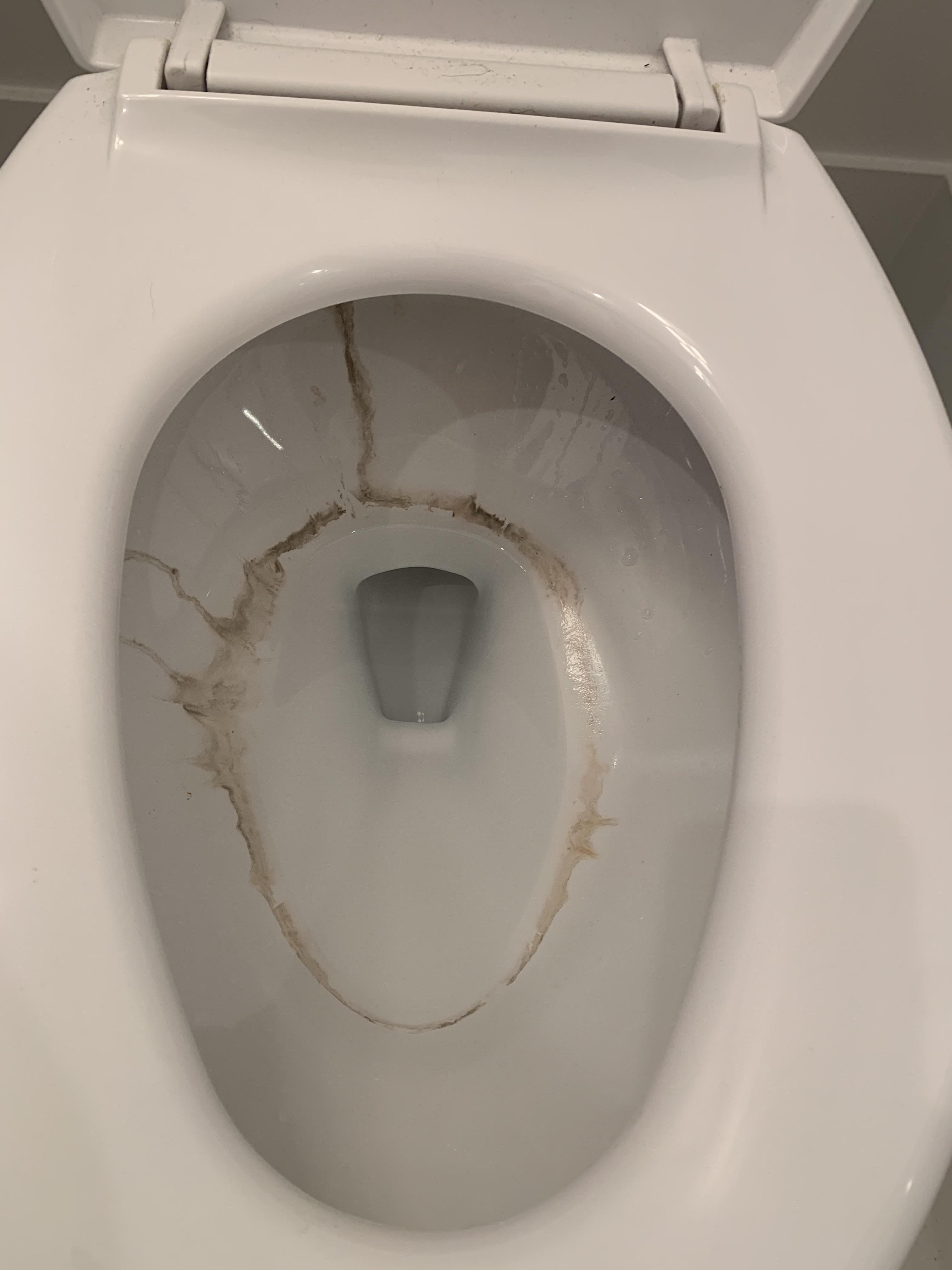 Inside A Toilet Bowl