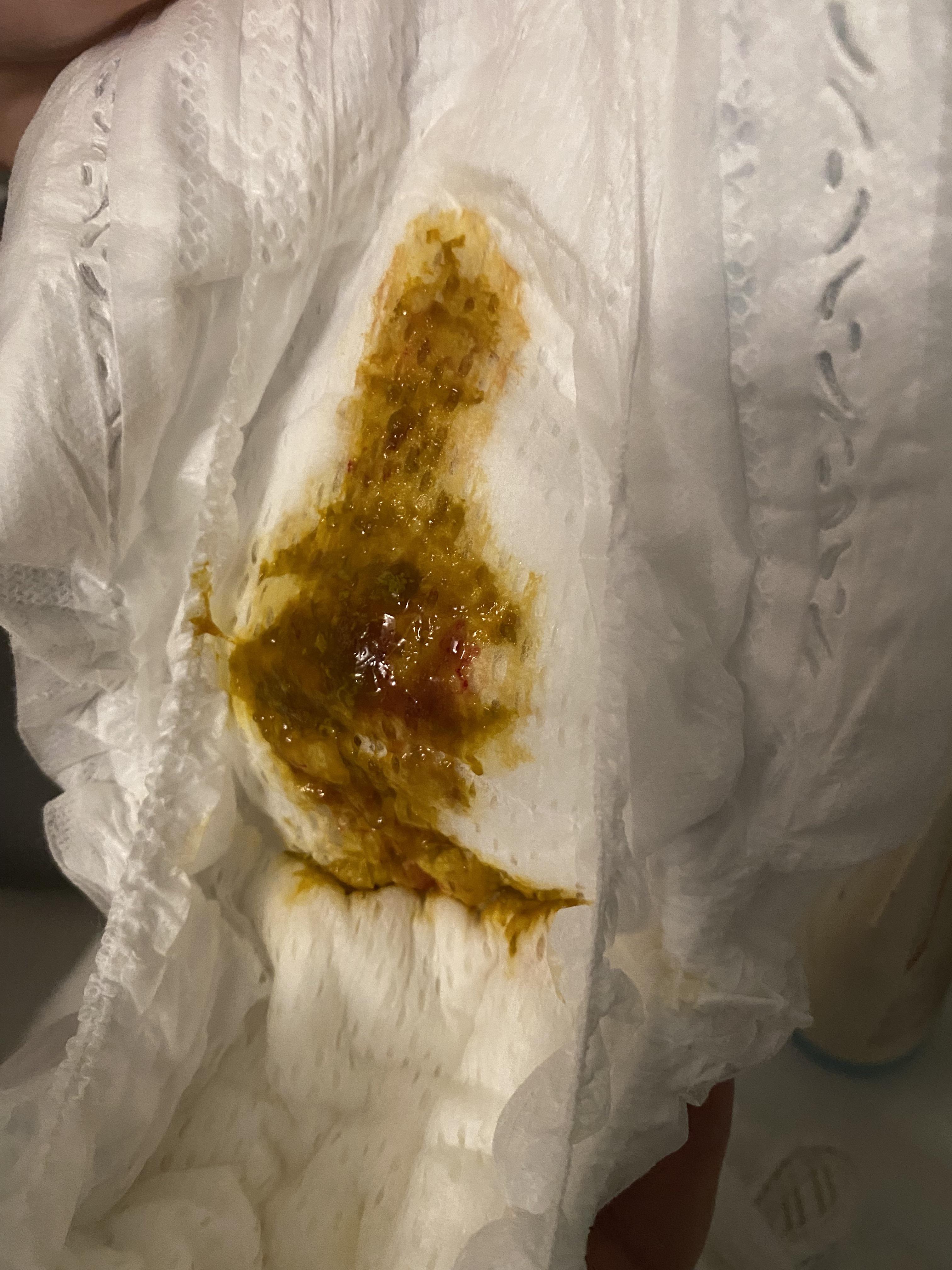 Blood in diaper, we all good? r/newborns