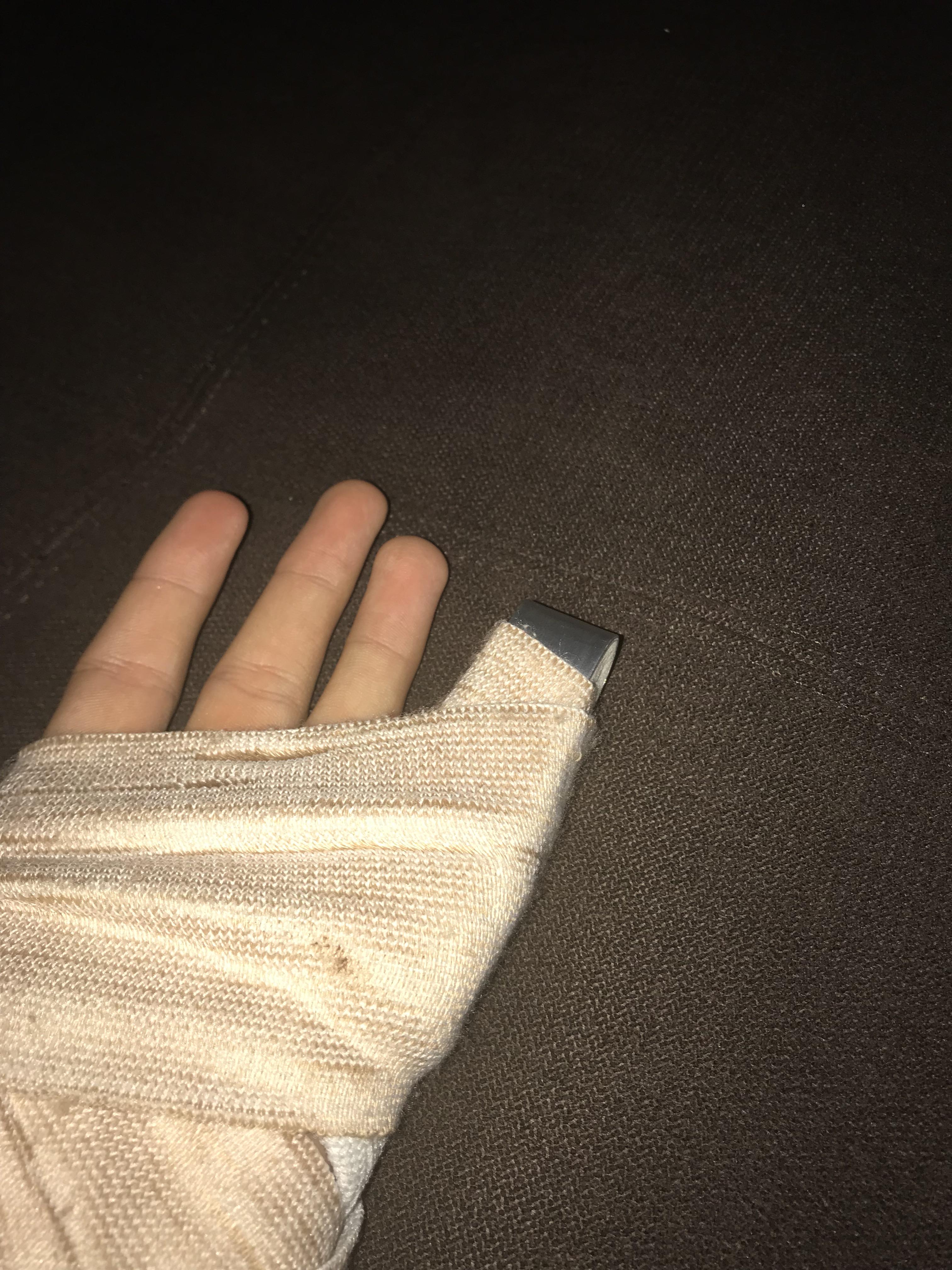 How To Bandage A Broken Finger
