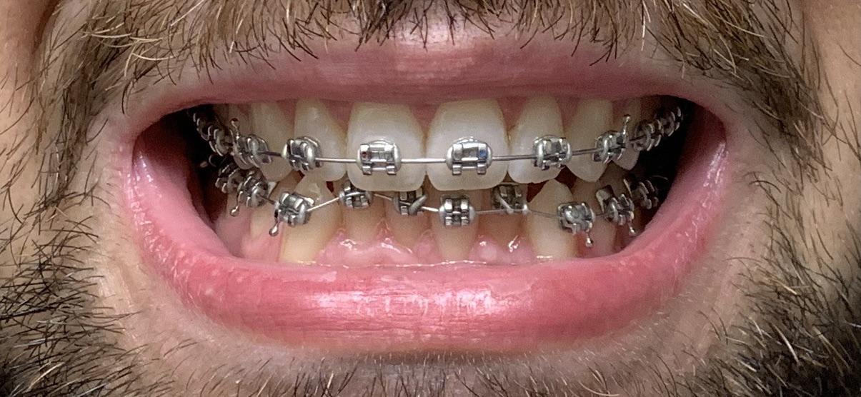 overview for Apprehensive_Park518