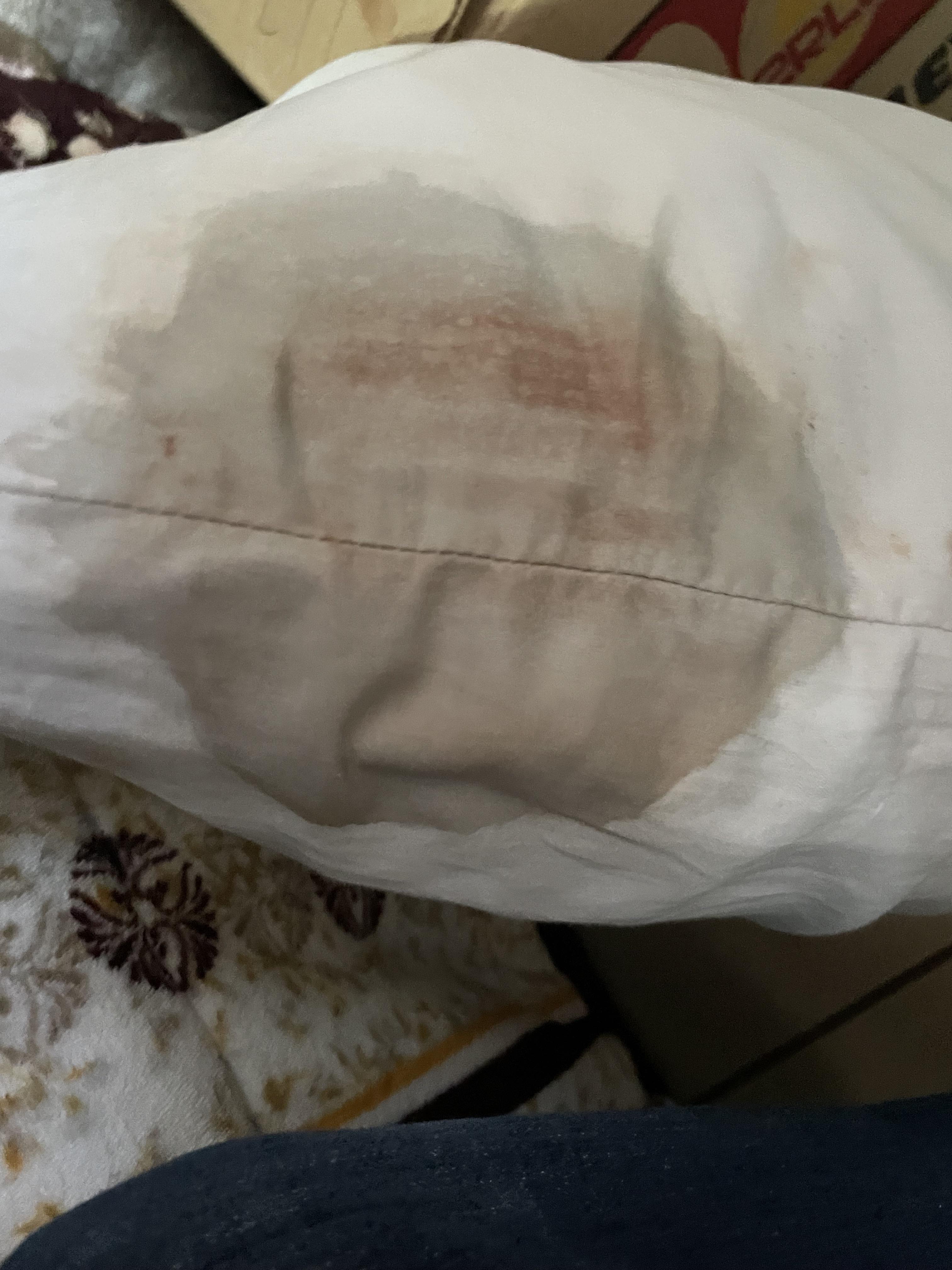 Pls help me get this blood stain out of my pillow case. r/CleaningTips
