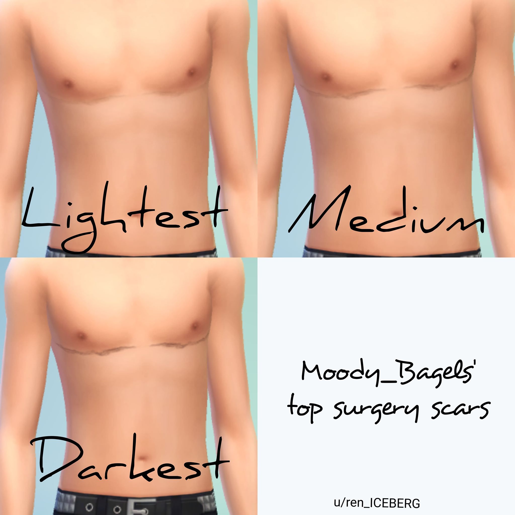 Any fellow trans simmers here? I made top surgery scars for The Sims 4 and thought I'd share! ftm