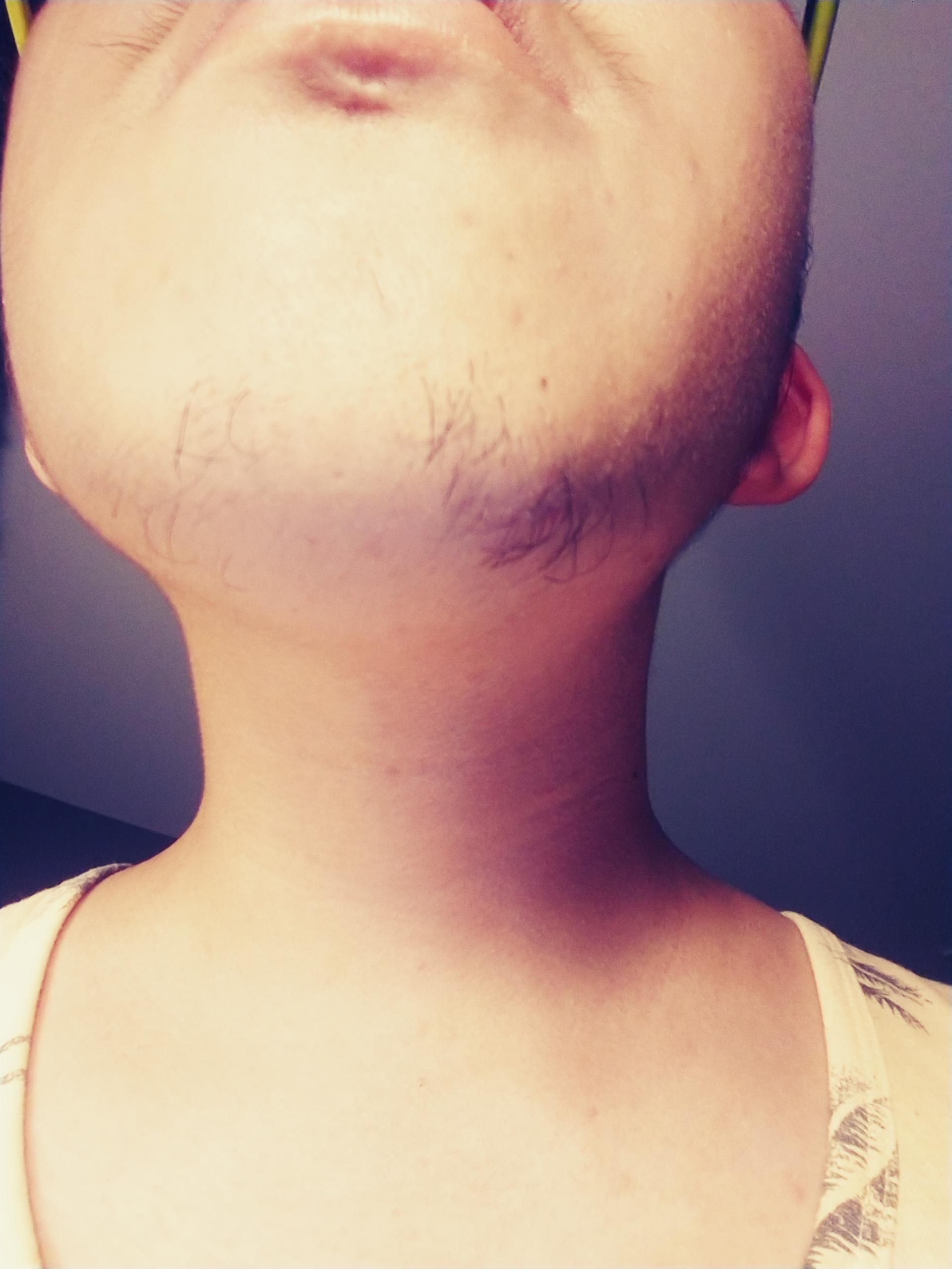 I'm 19 and my chin hair always comes in uneven and not as full as I'd