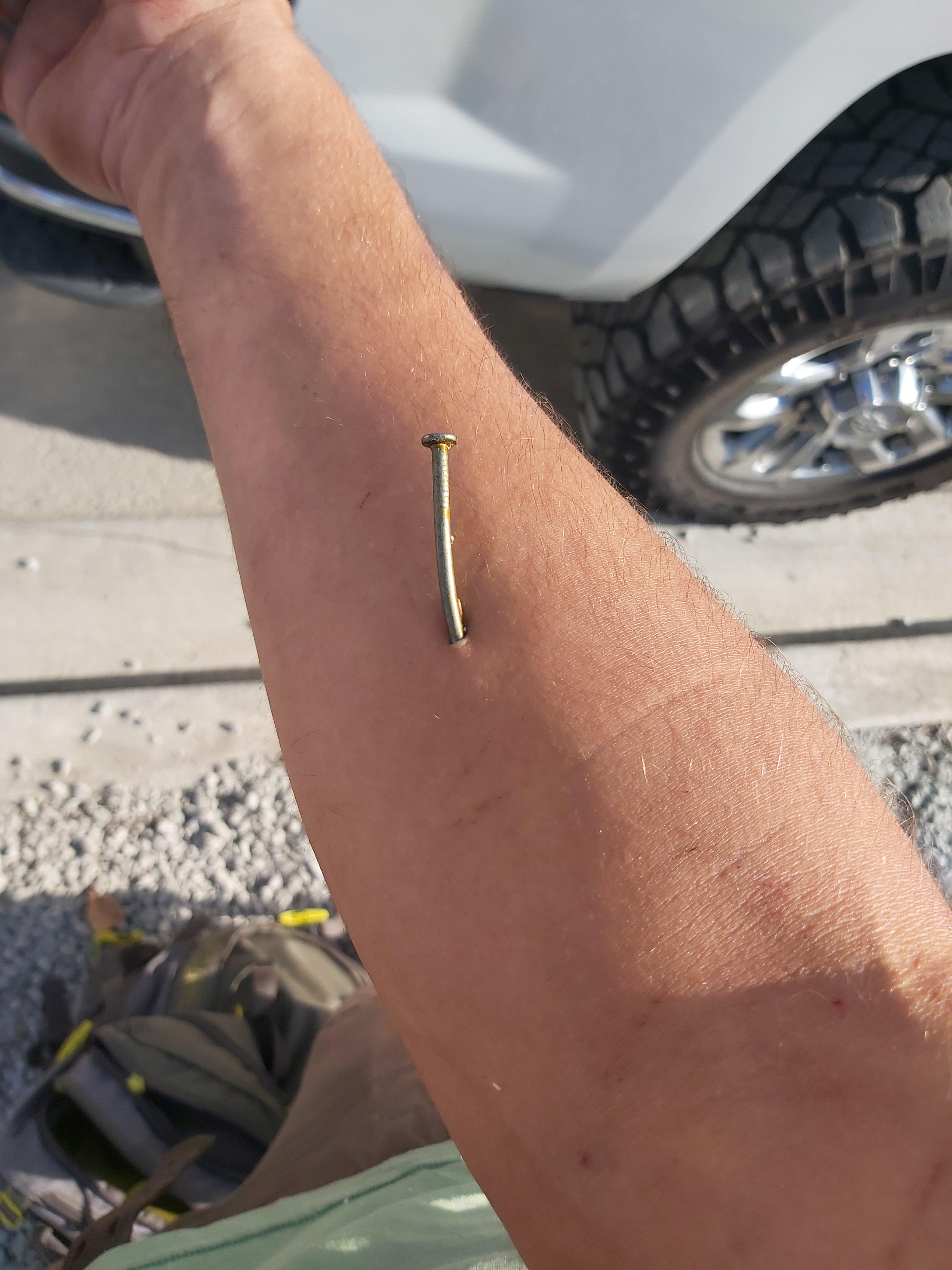 Nail came out of the nail gun, hit a knot, and flew 2 feet into my arm