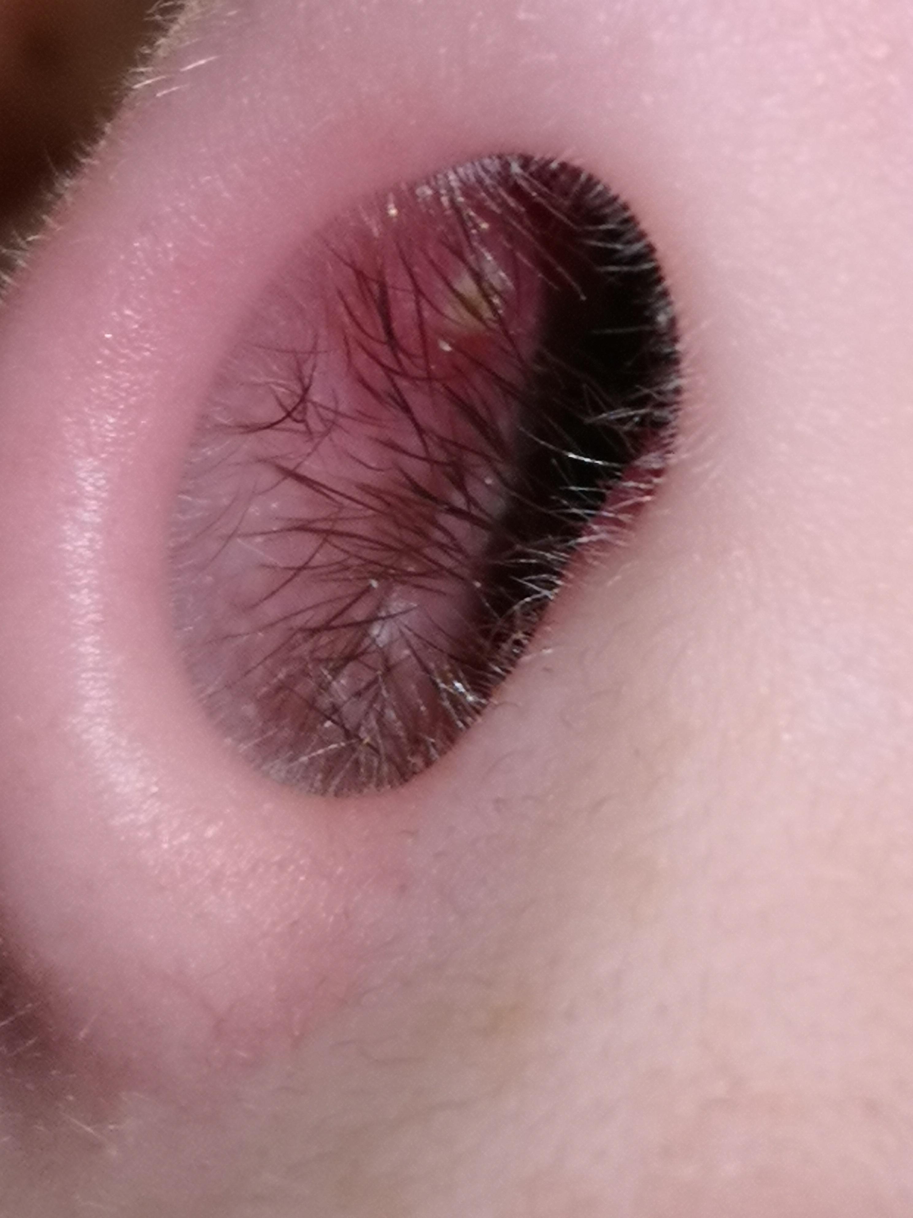 Woke up to a sore nose this morning popping