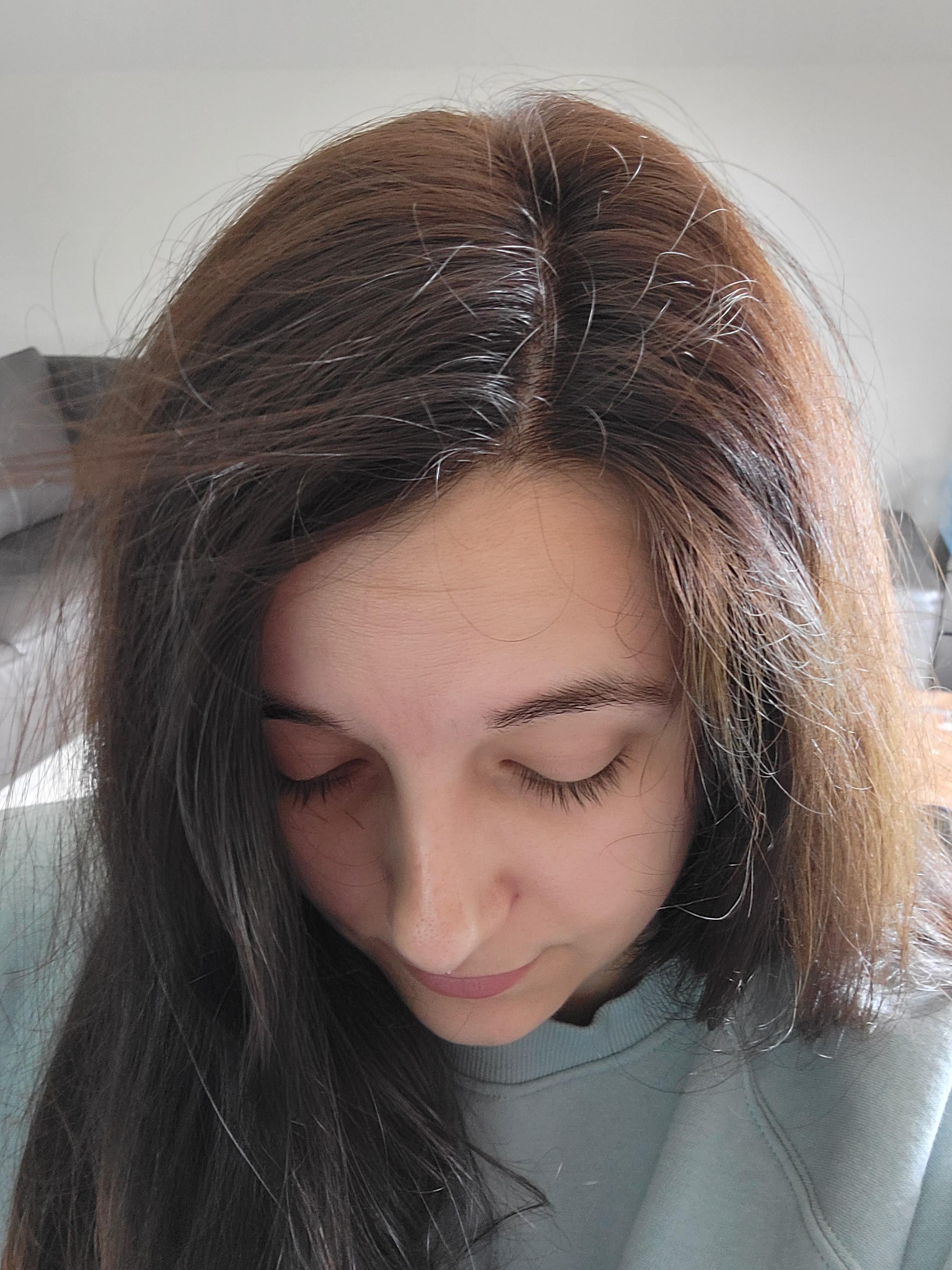 Hair Breakage or New Growth? r/NoPoo