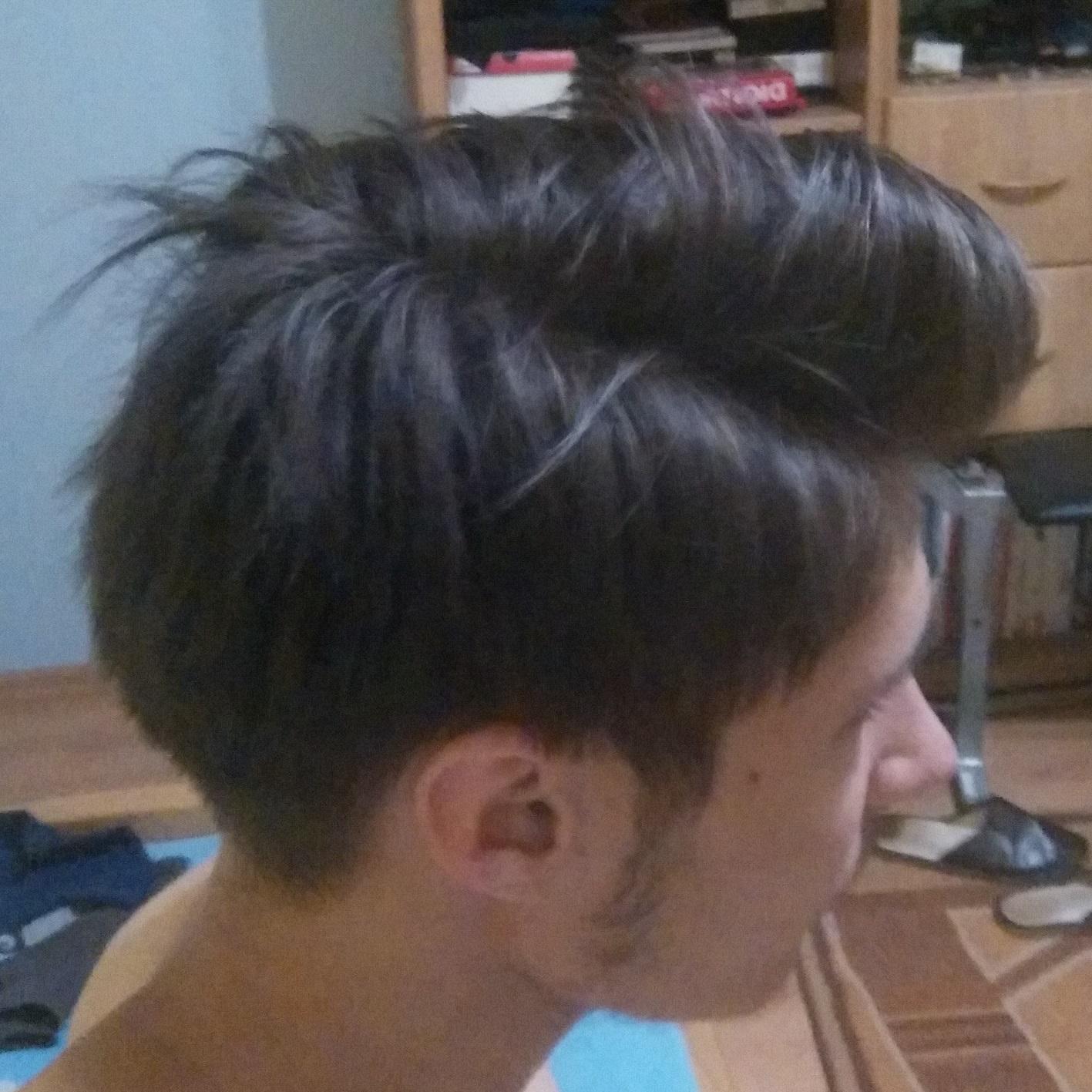 The natural parting of my hair is too high What can be done? r