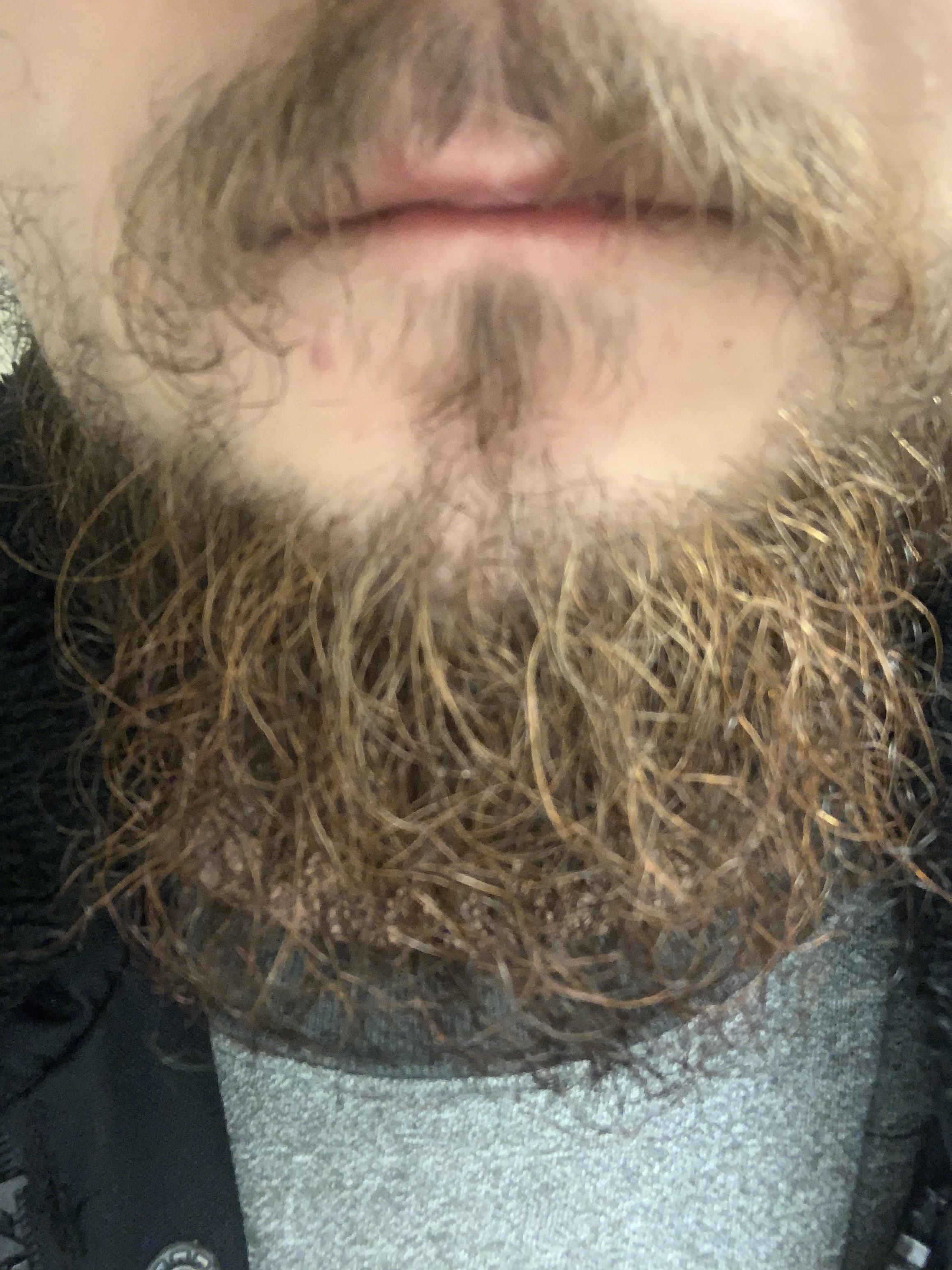 Can someone explain why my beard/mustache hair is different colors? My