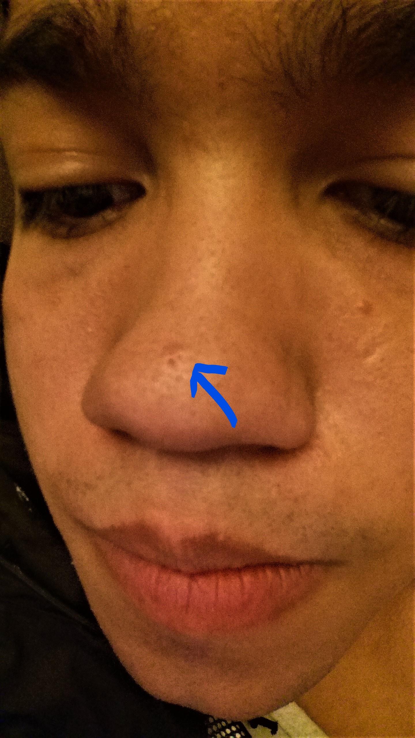 Will The Scar On My Dogs Nose Go Away