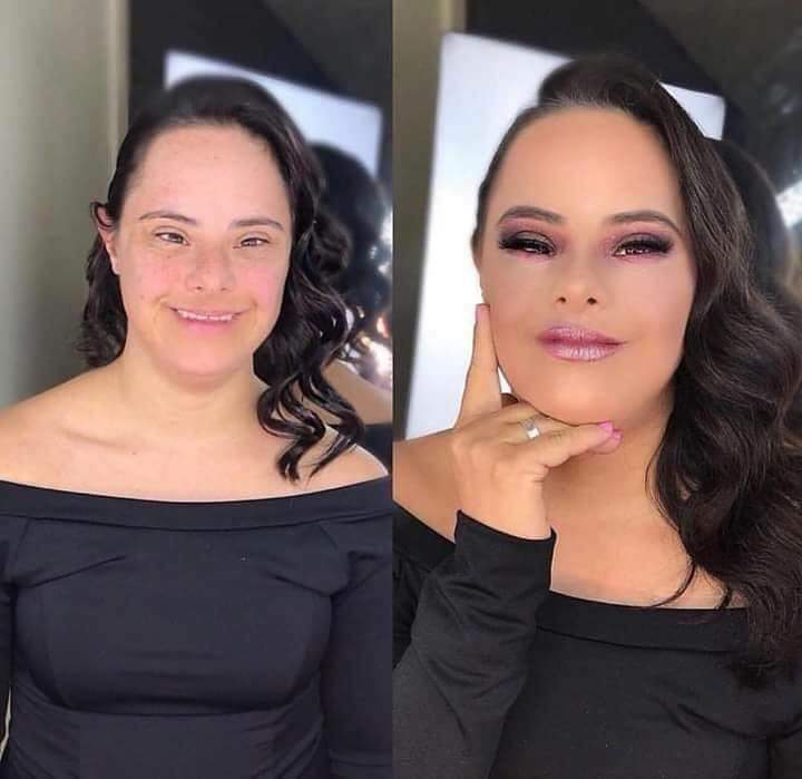 Her down syndrome couldn't stop that Glow up r/pics