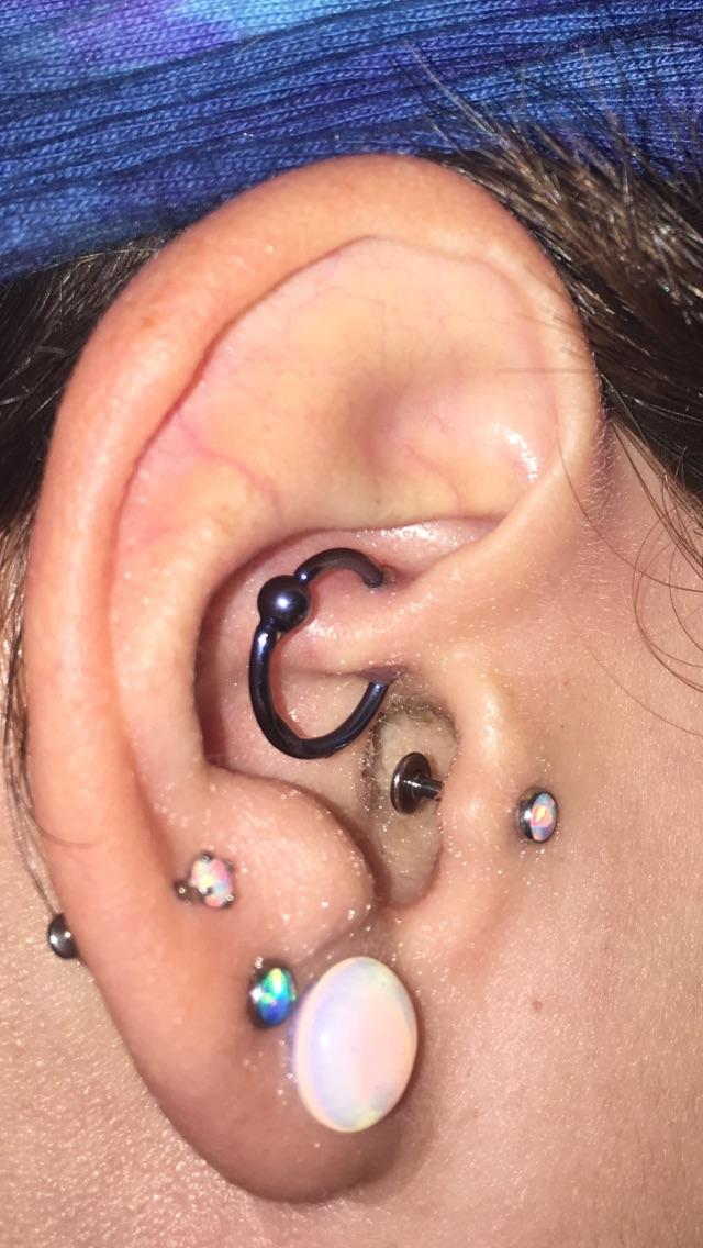 Daith Piercing Healing Bump Verzameling