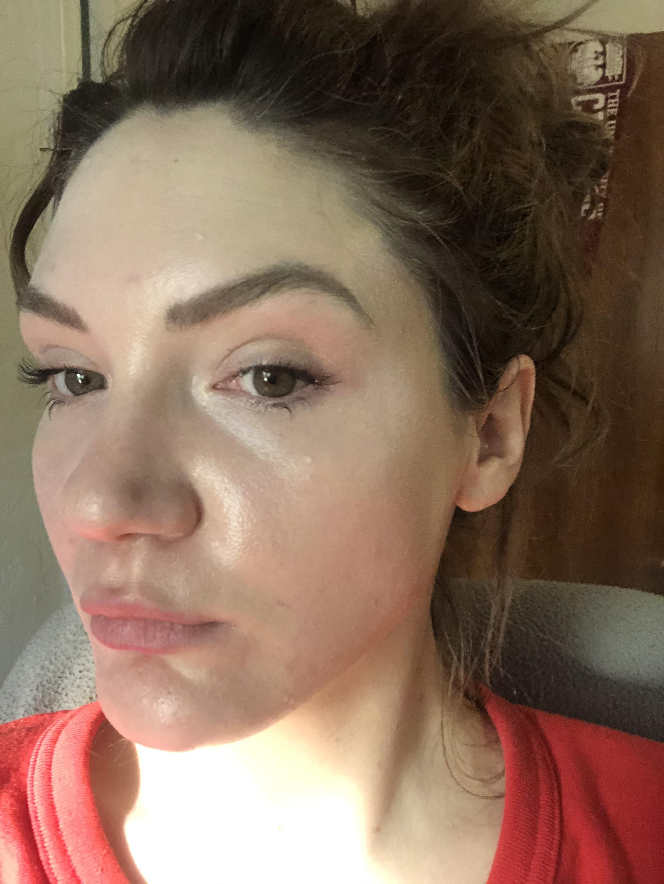 Collagen loss under eye (txt in comments). 30PlusSkinCare