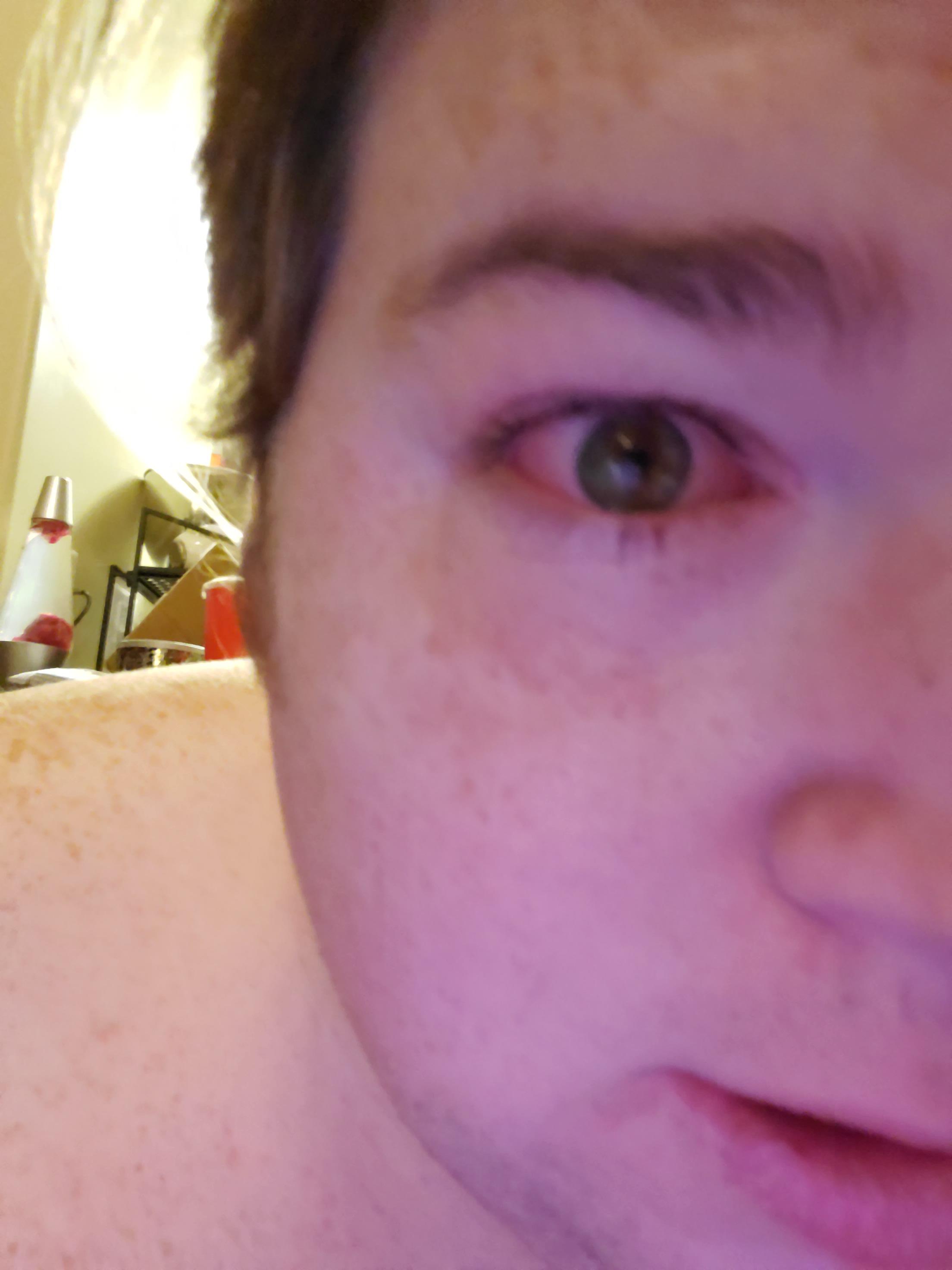 My eye gets super irritated randomly and it'll cry for hours on end