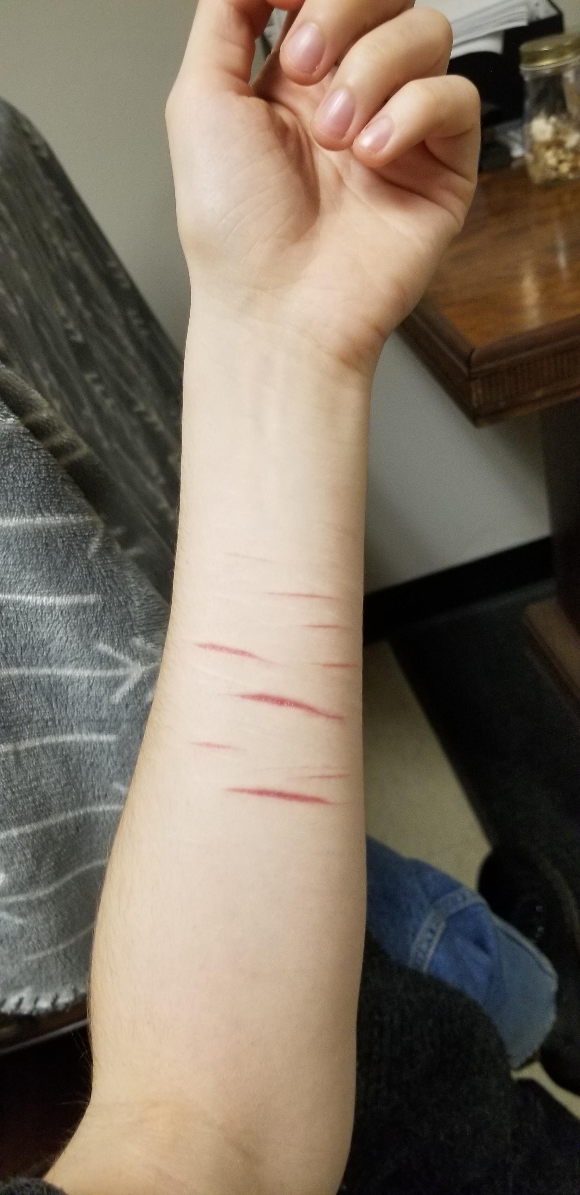 Question?? how long does it generally takes y'all's deep self harm