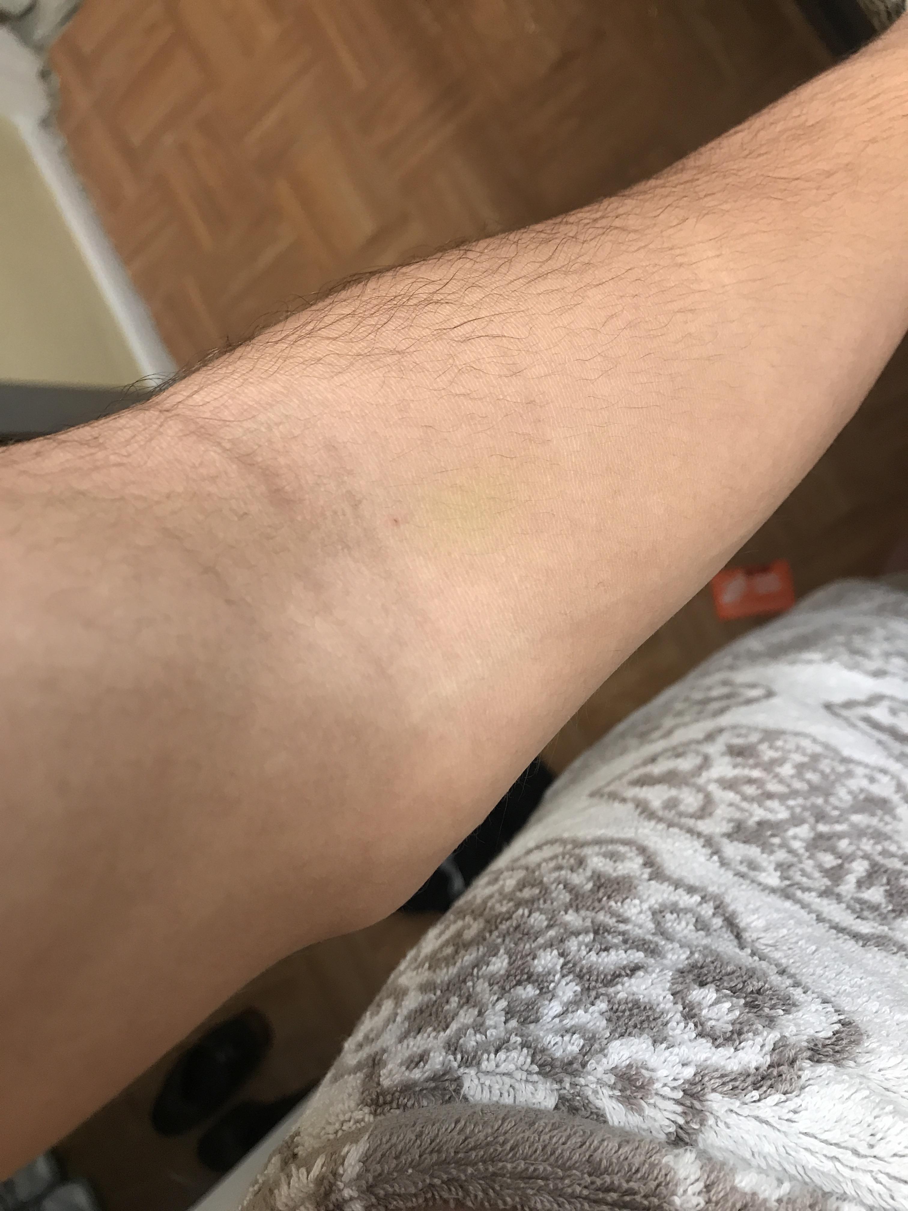 Is it me or does anyone else see a green bruise where my forearm and