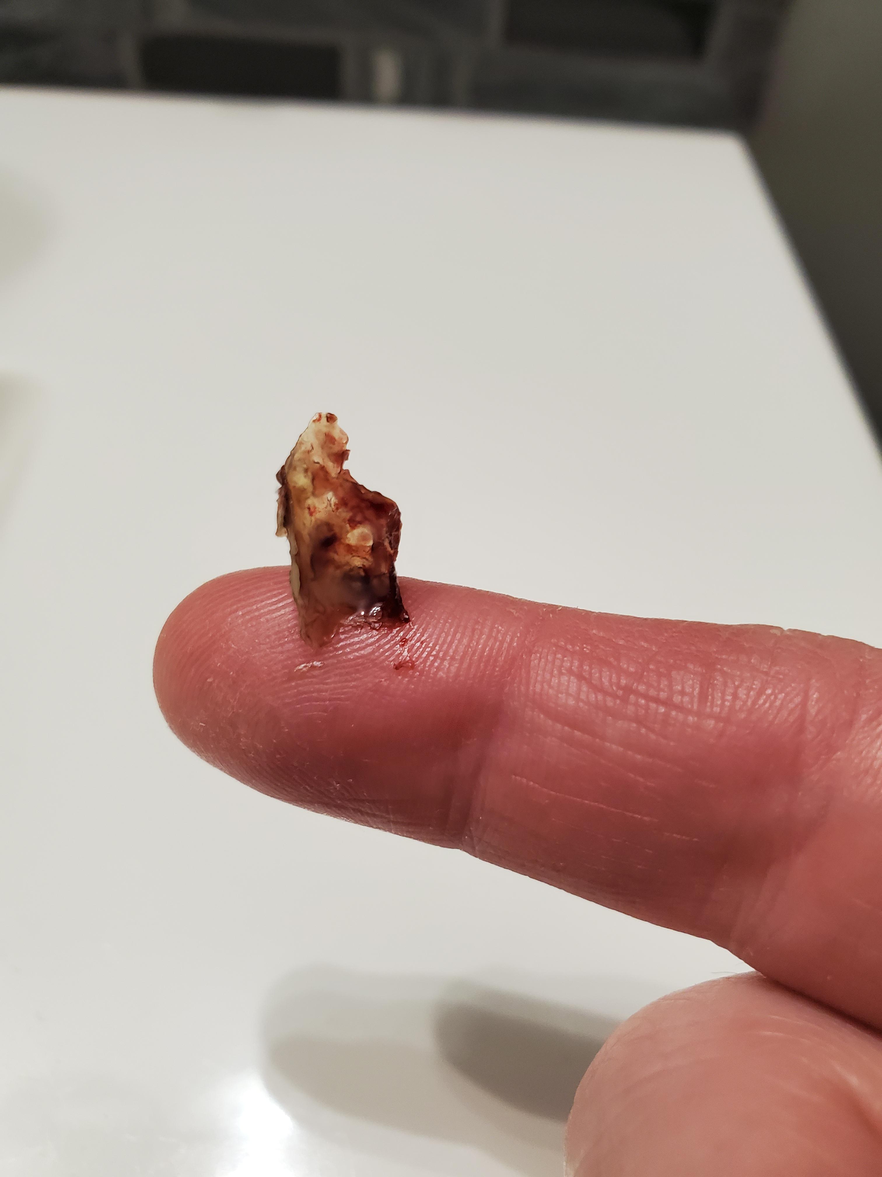 Thin and crusty r/boogers