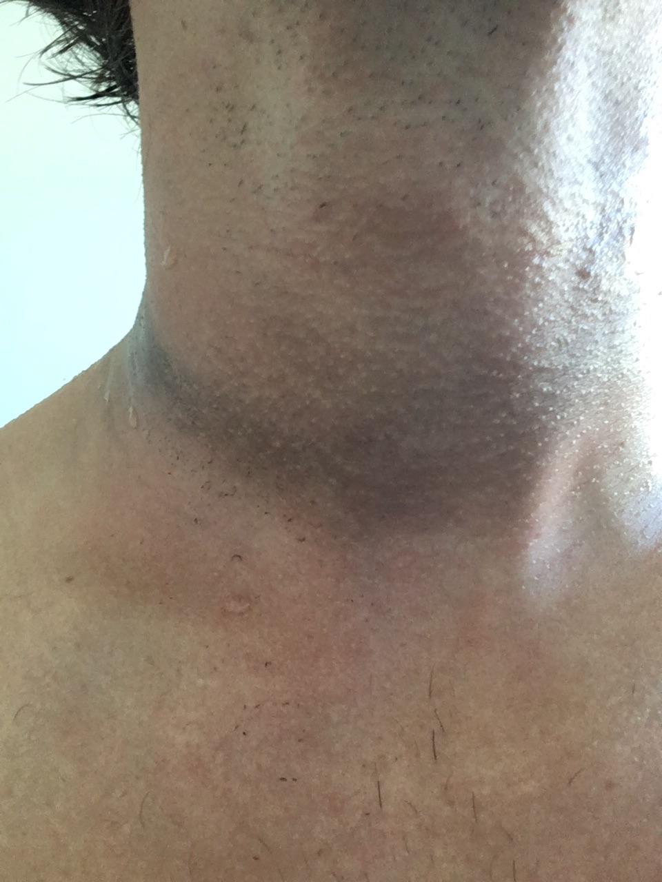 Why does my wetsuit leave this black residue around my neck? I scrub it