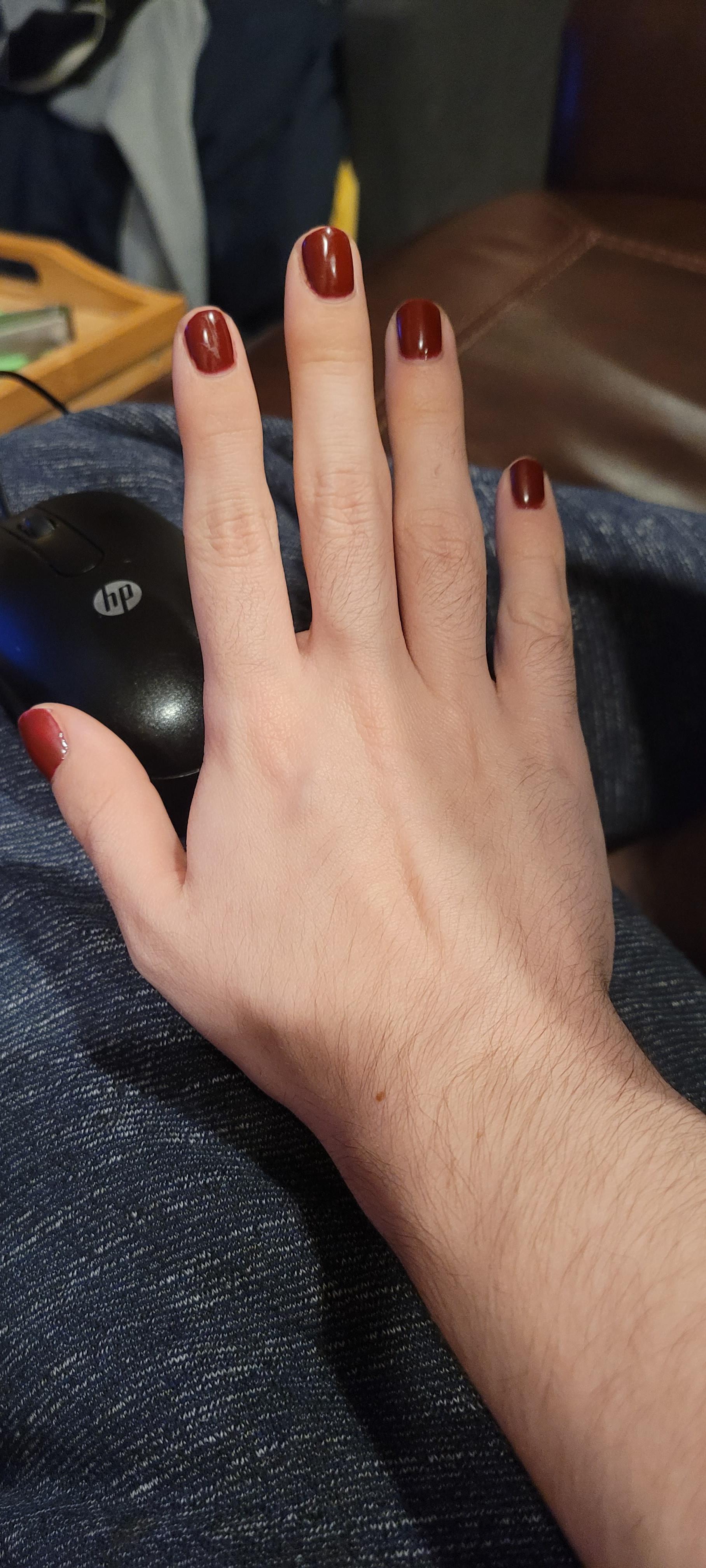 9 months on T (ftm, he/him only pls) and finally feeling like i can