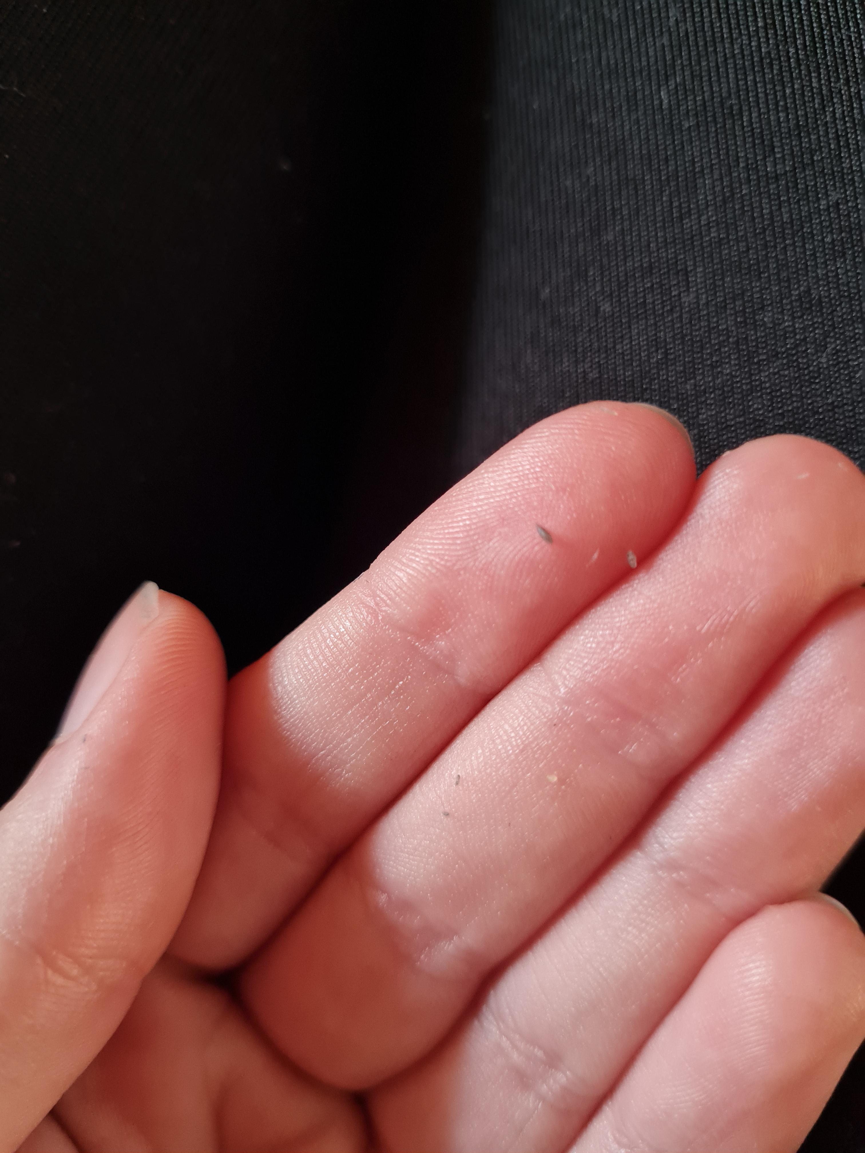 Does anyone know what this stuff is? It comes off when I rub my face r/Skincare_Addiction