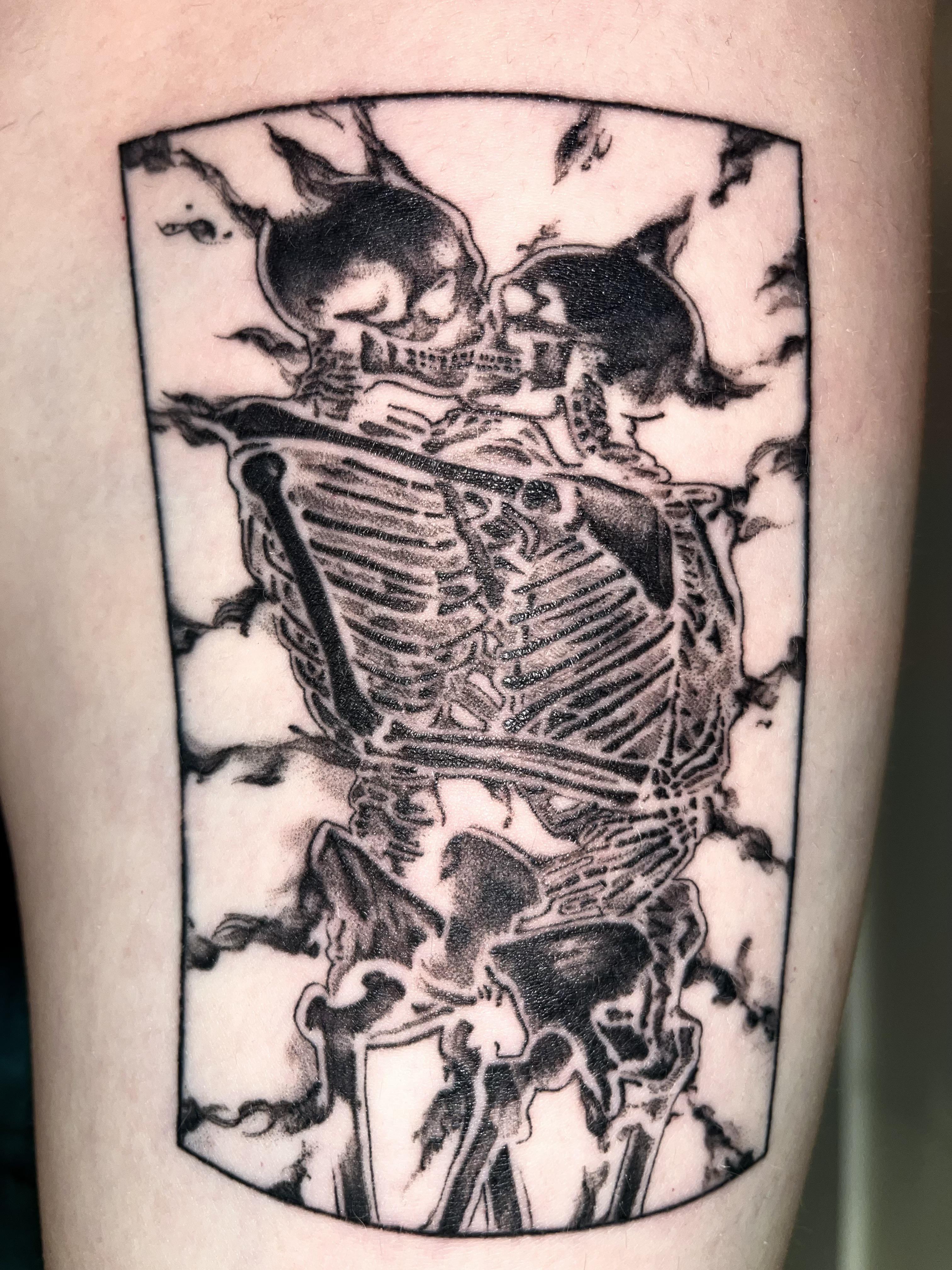Allergic Reaction To Black Tattoo Ink. : R/Tattooadvice 4032_x_3024_jpg