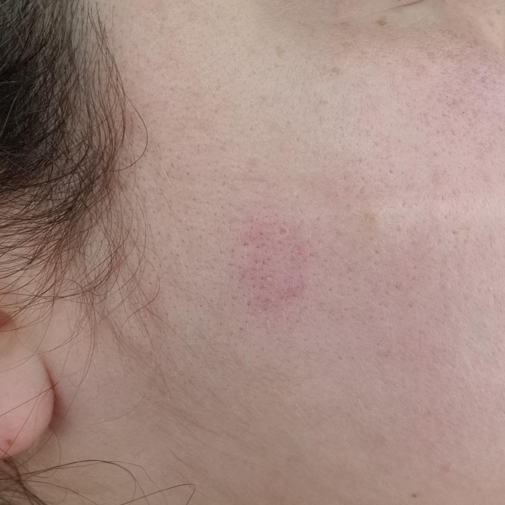 Does anyone have an idea of what this red mark is? It has been in the same spot and shape for