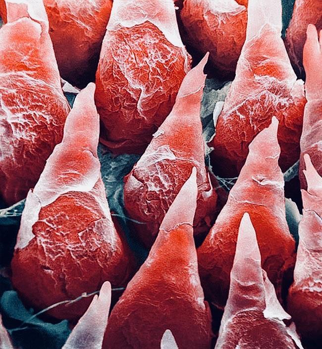 The human tongue under an electron microscope. interestingasfuck