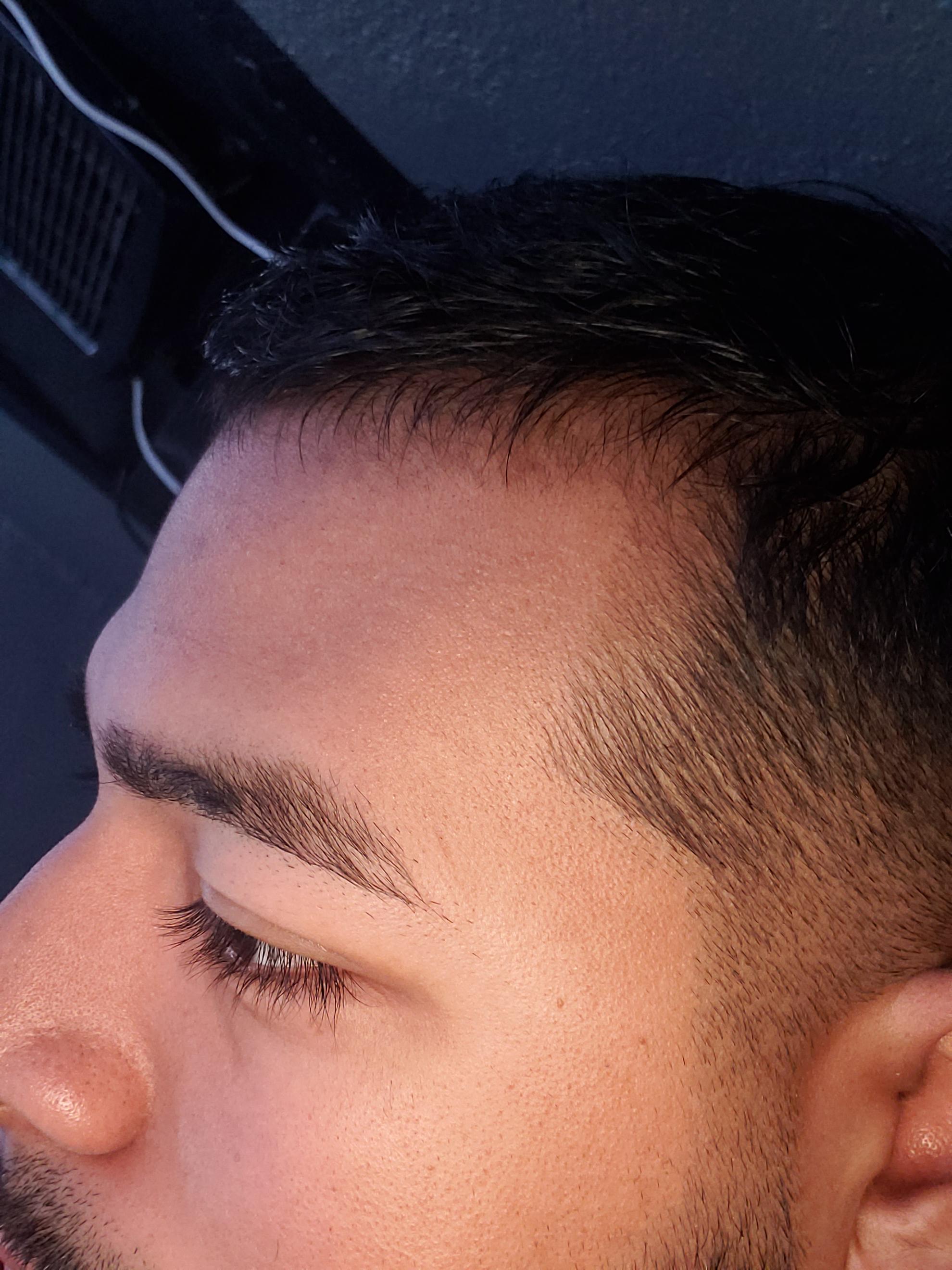 Day 50, 5 minoxidil and 1 mm derma rolling progress r/Hairloss