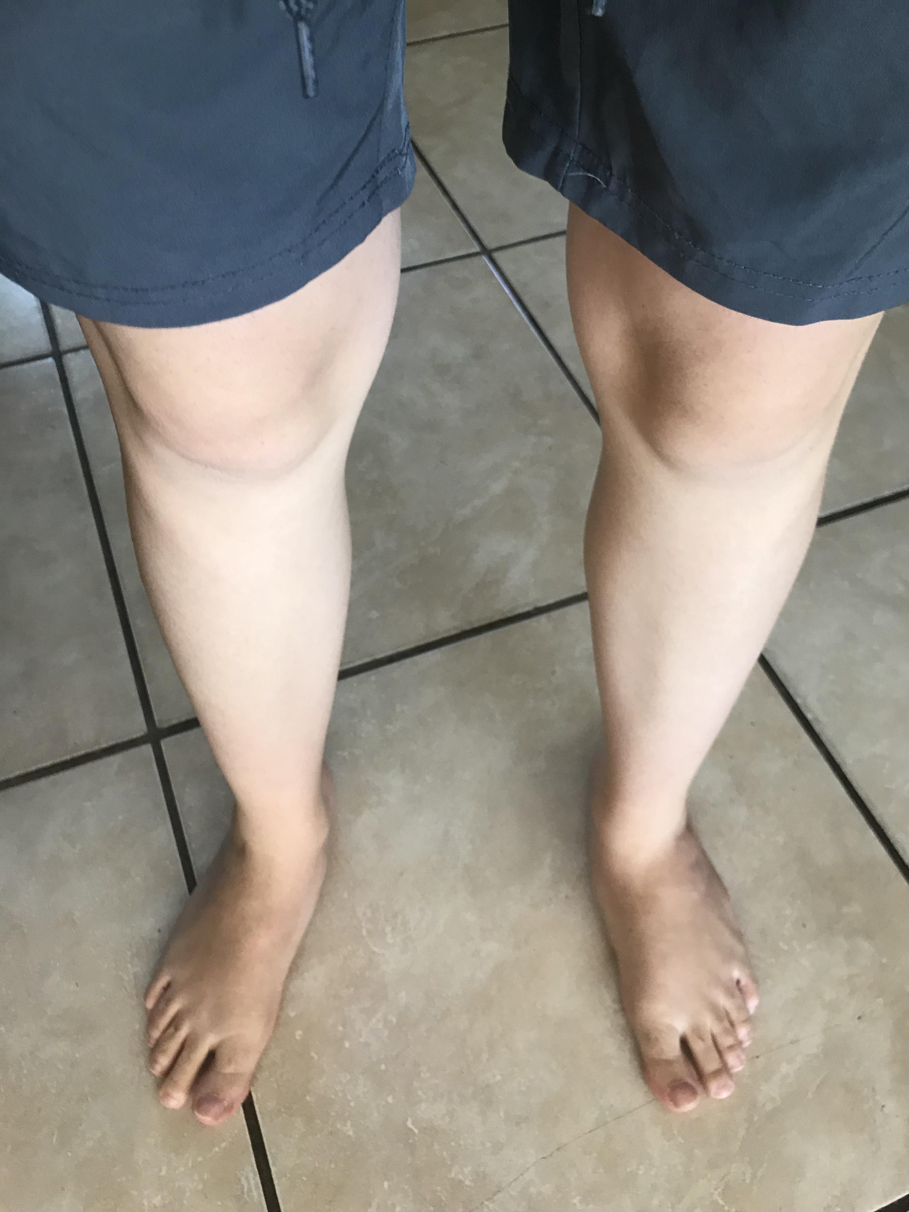Should I Shave My Legs For Ironman at Mark Nathan blog