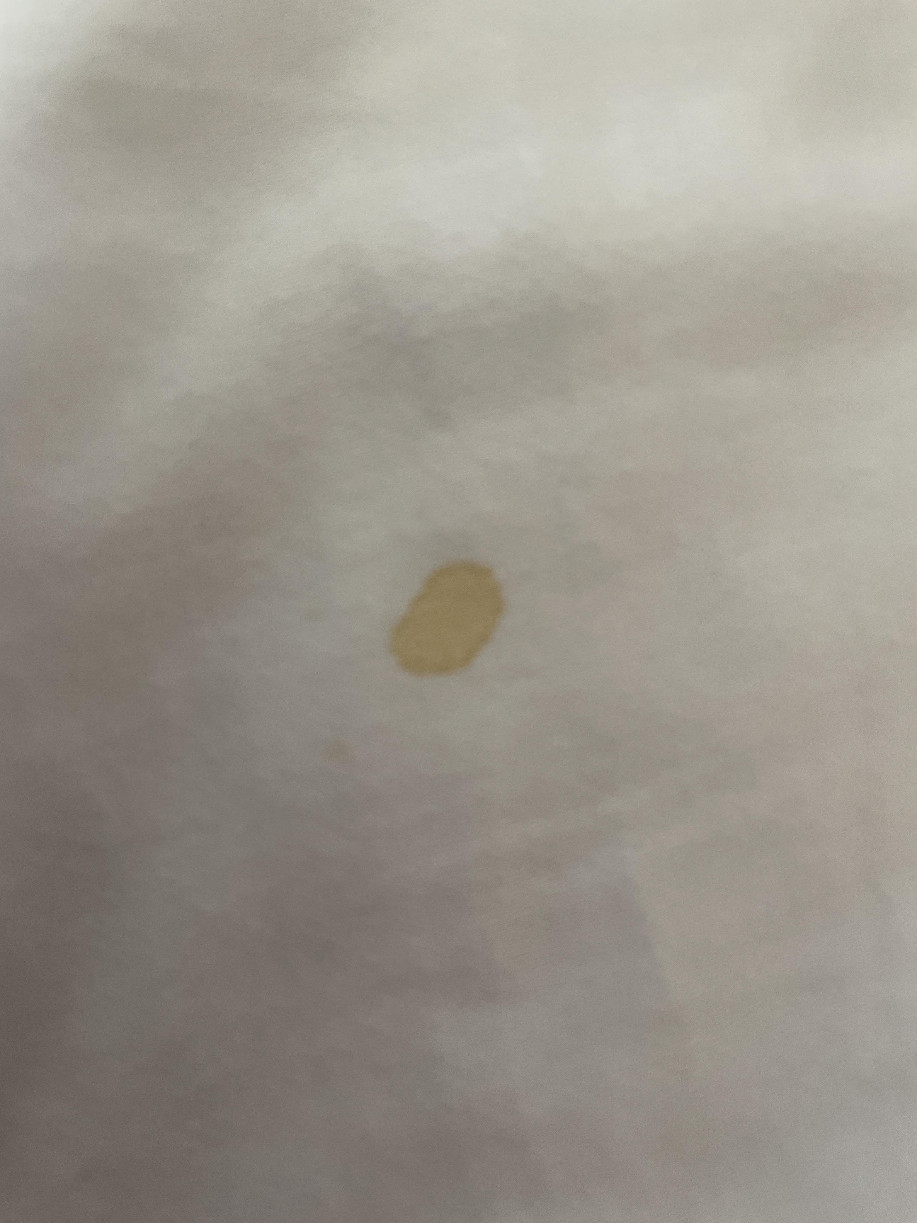 Found this yellow stain on sheet. Could this be bedbugs or probably