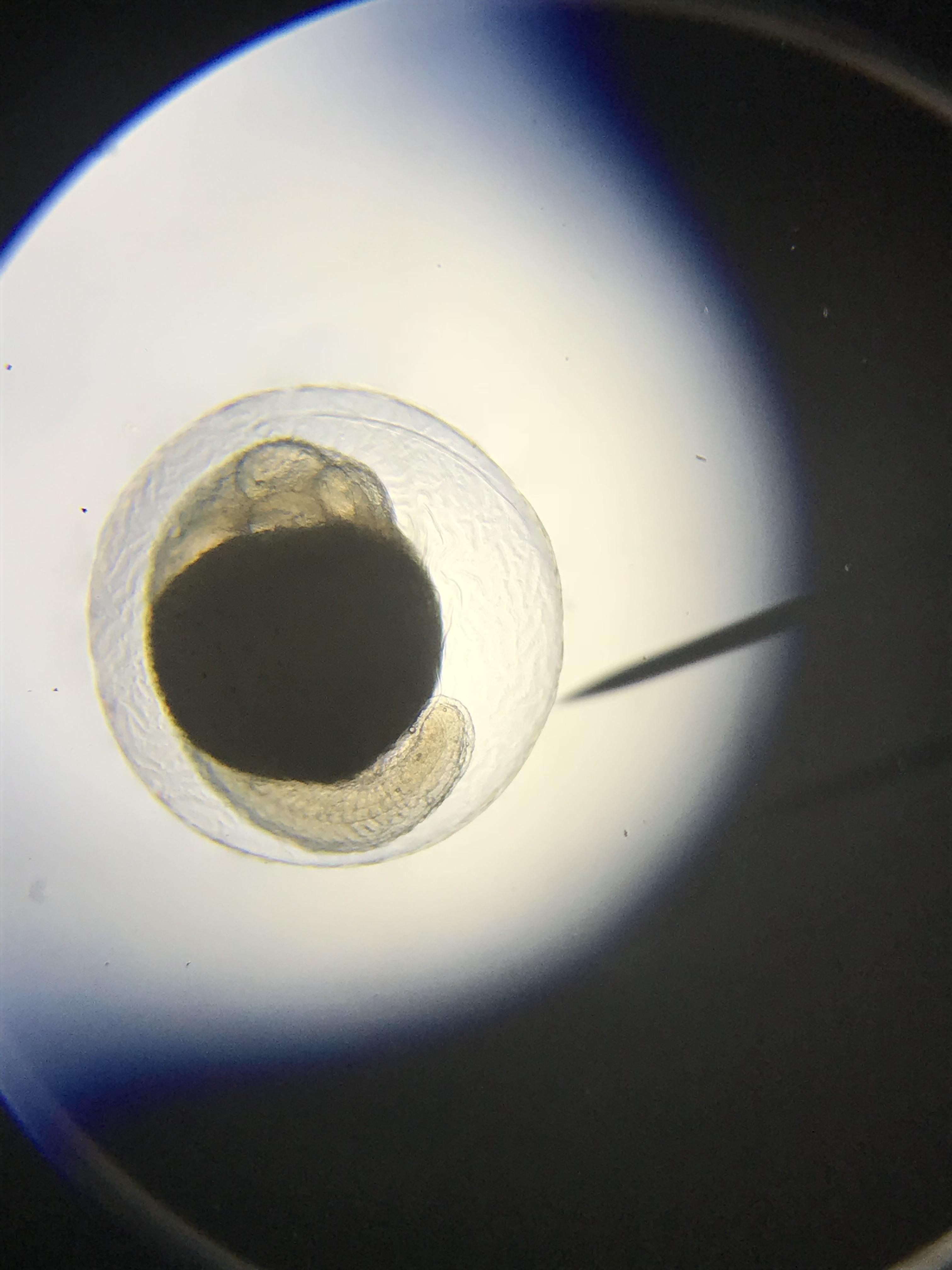 Fertilized betta egg under microscope. r/bettafish