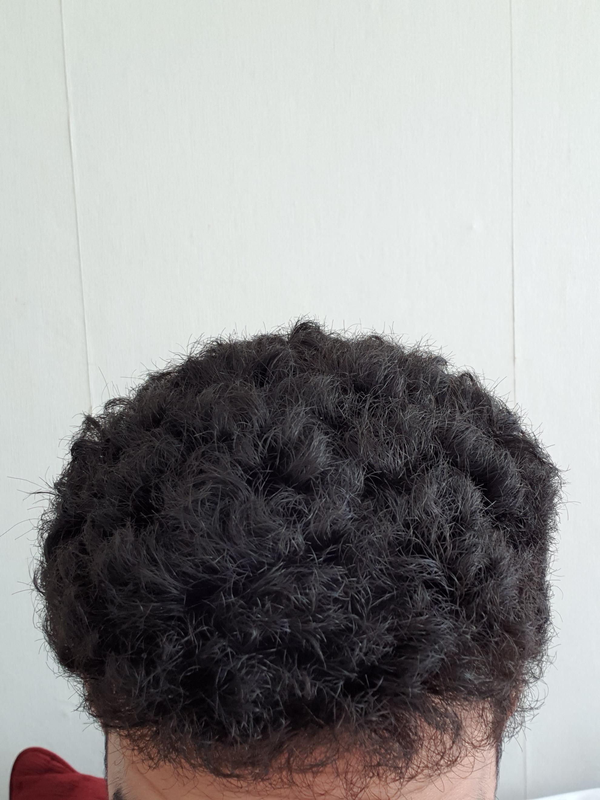 My hair feels hard and dry most of the times. it also hurts if I touch